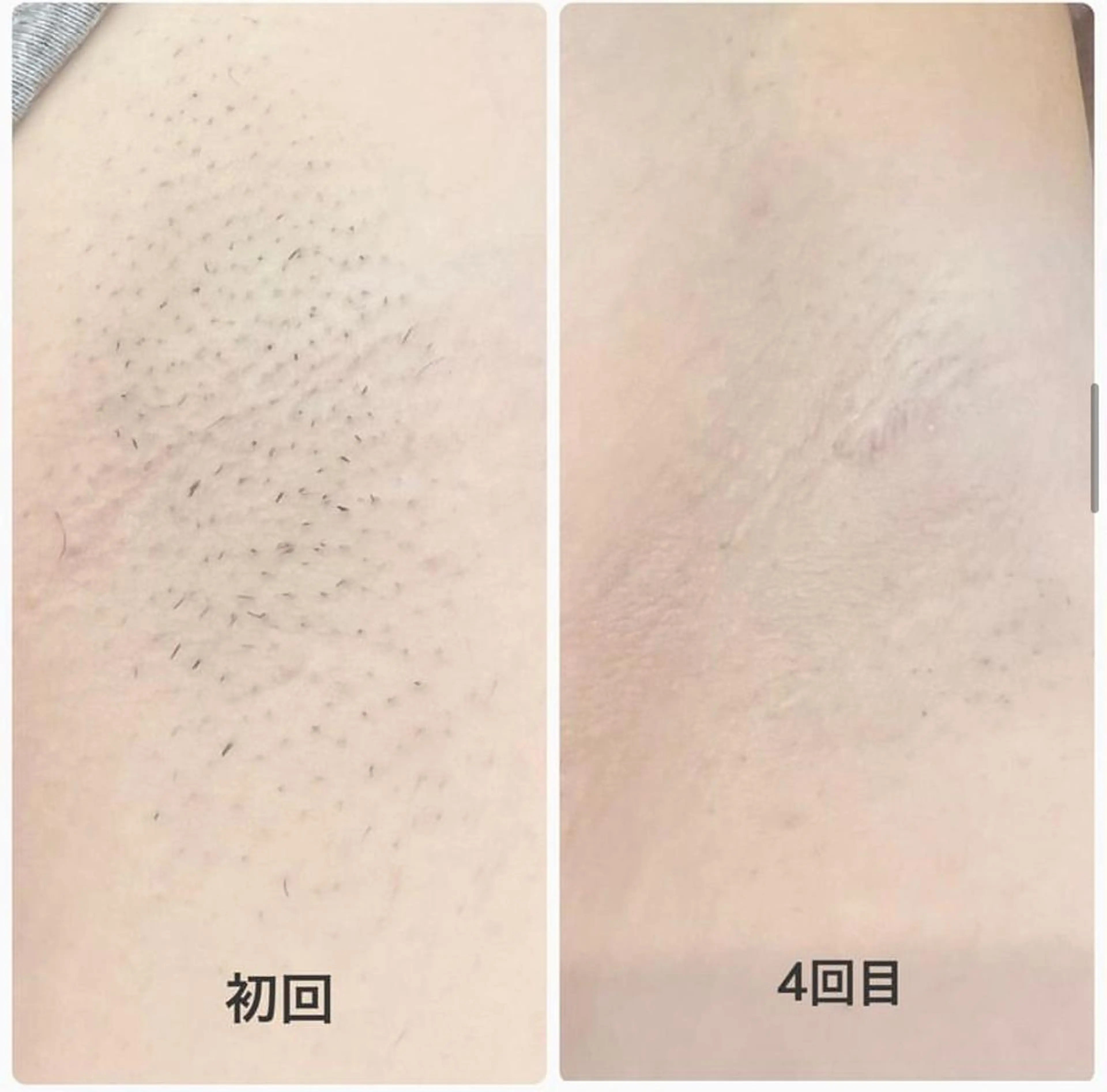 脱毛まつげサロン JESSICA荻窪店の眉毛・アイブロウイメージ