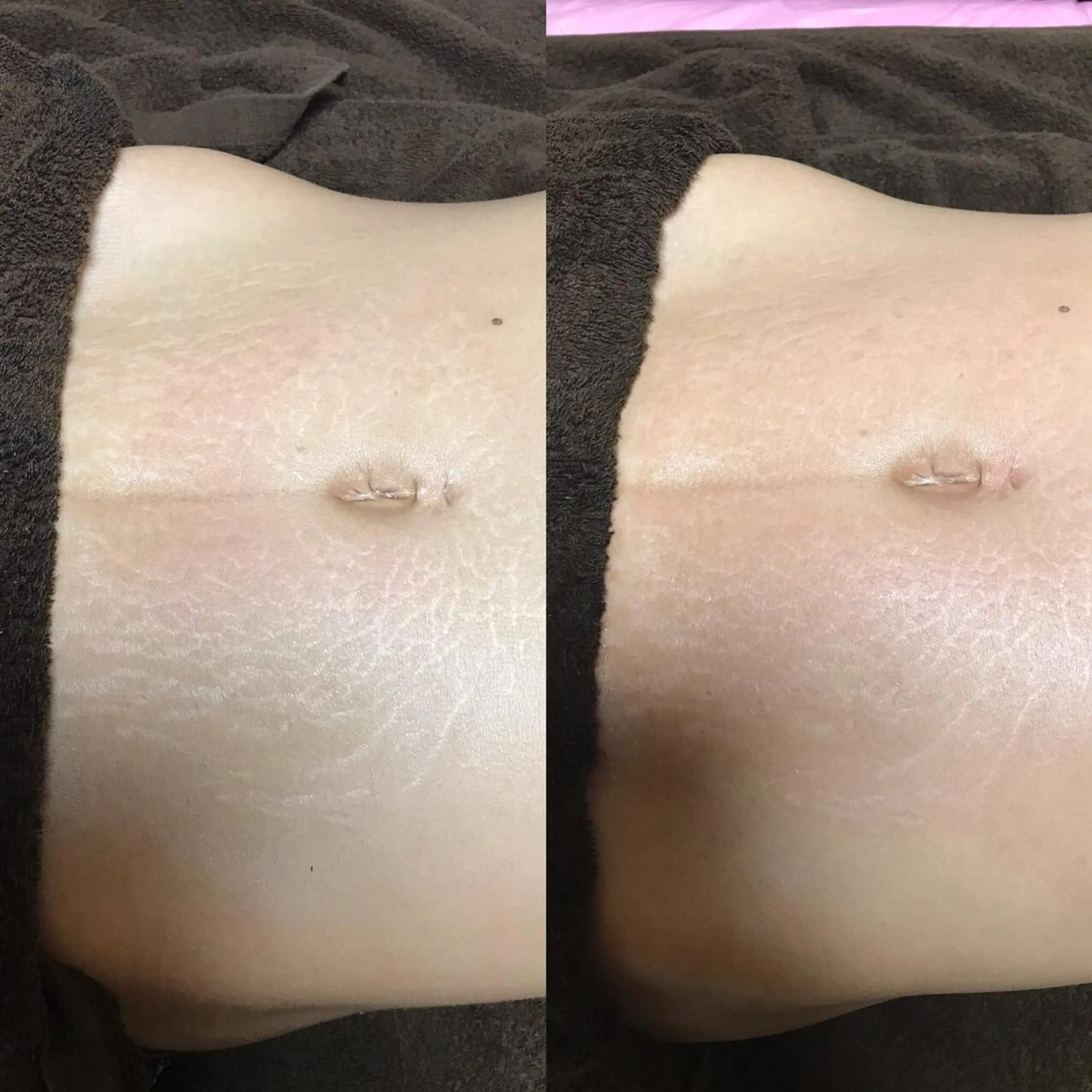 首・肩こり専門リンパ ケアサロンSENKAのエステ・リラクイメージ