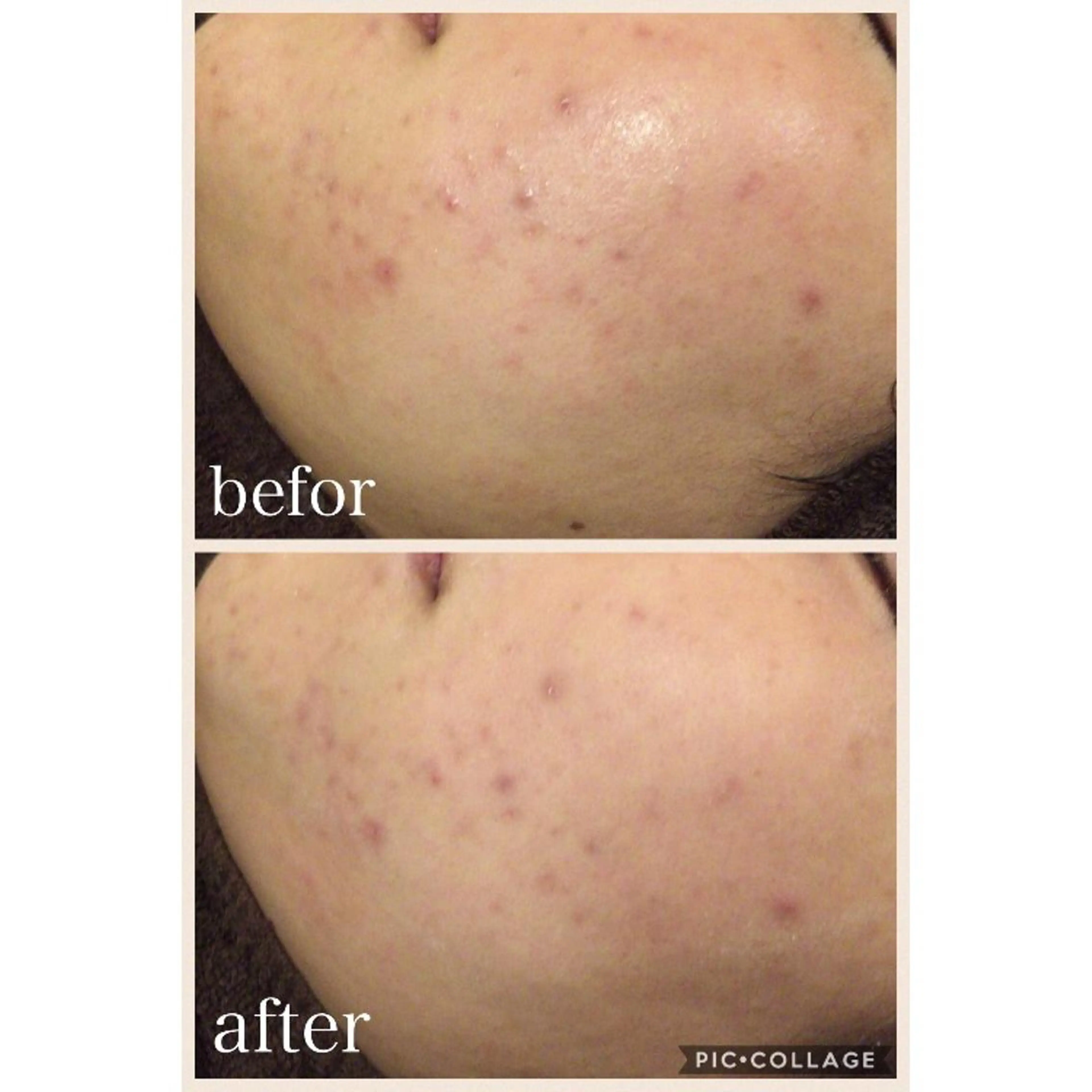 ニキビ跡専門サロン Ａｉｎａのエステ・リラクイメージ