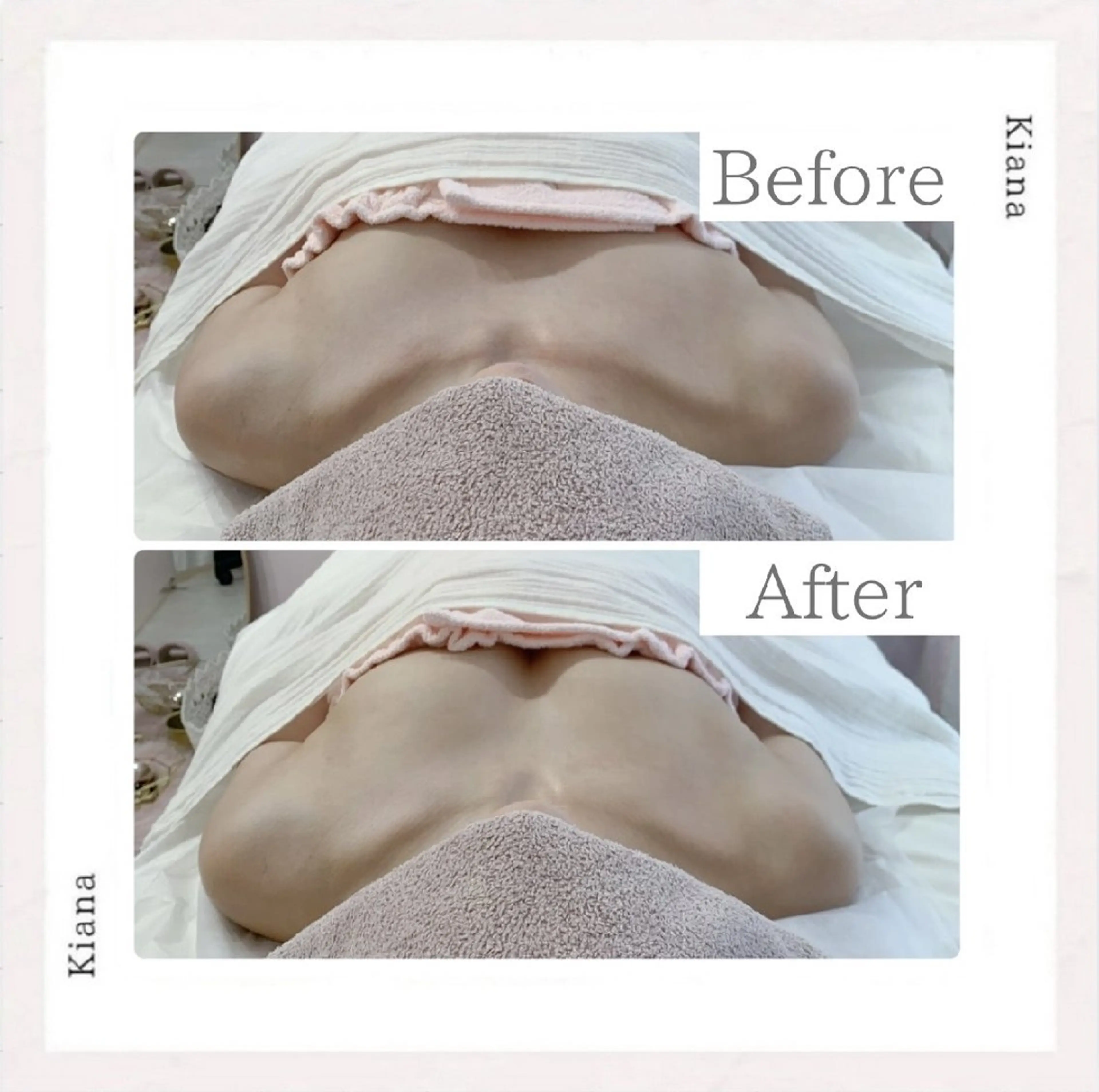 エステ リラク 【バスト専門店 】 Kiana のエステ・リラクイメージ