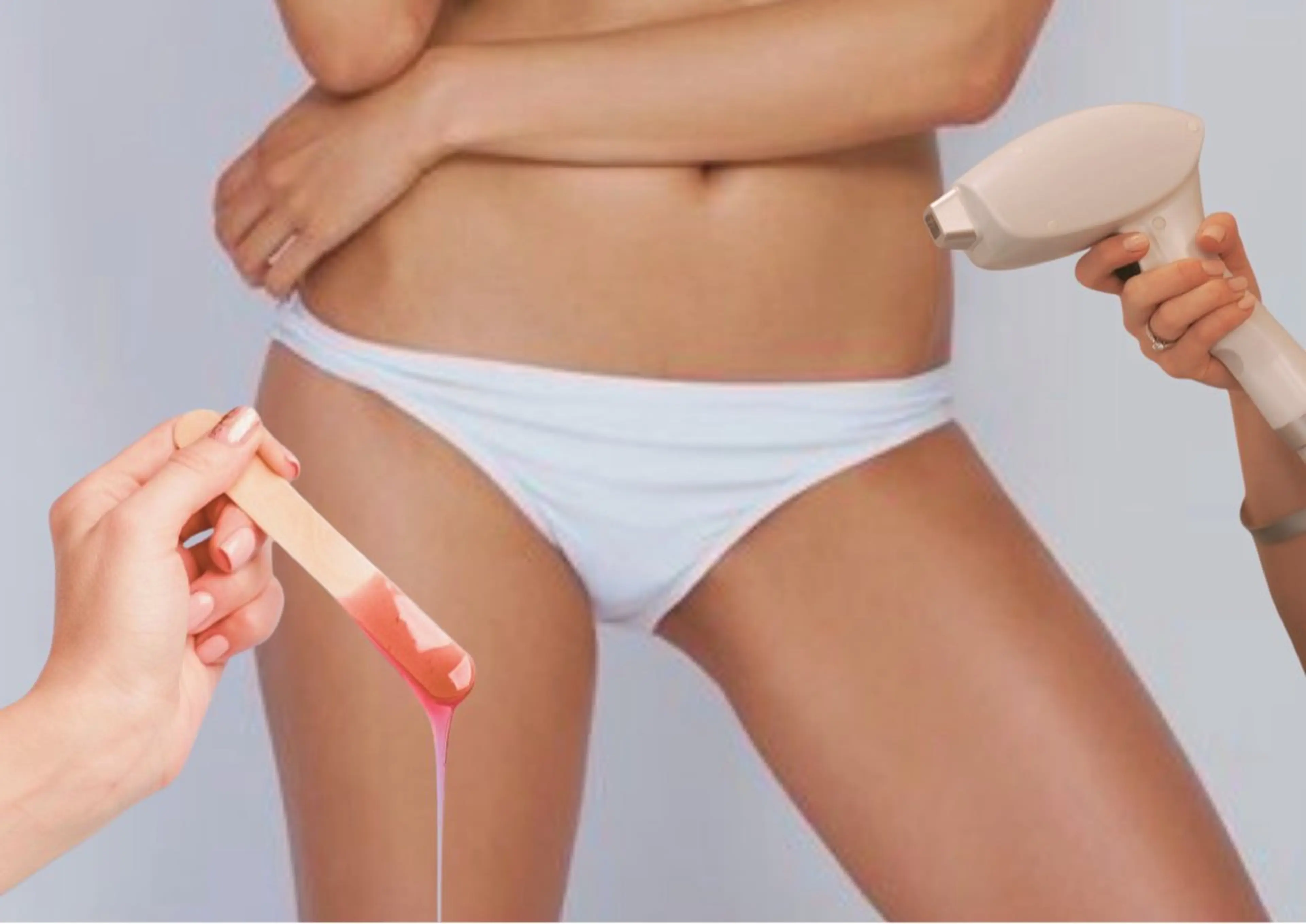 【女性】VIO W脱毛（ワックス脱毛×光脱毛）の写真