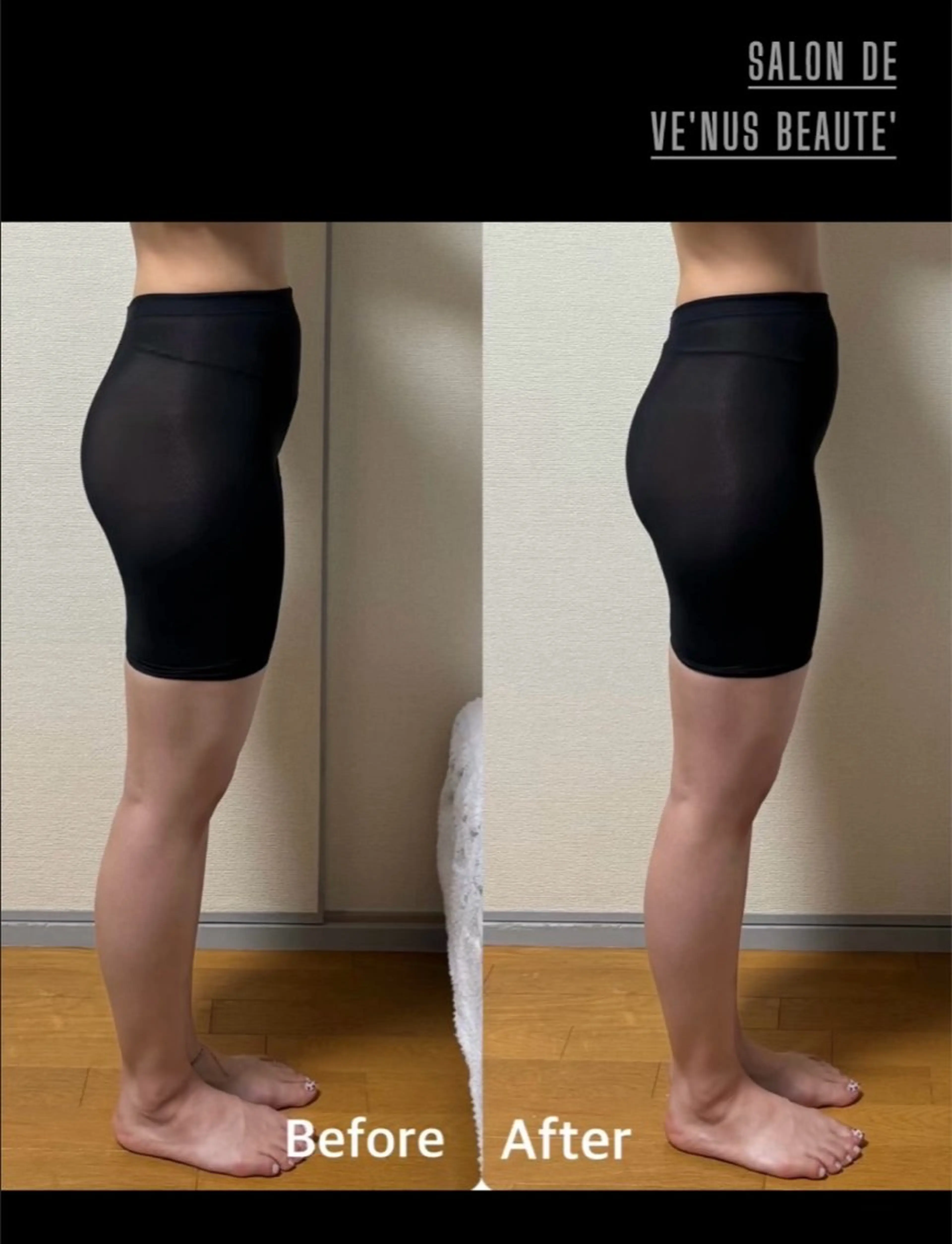 その他 ヴィーナス ビューティーのエステ・リラクイメージ