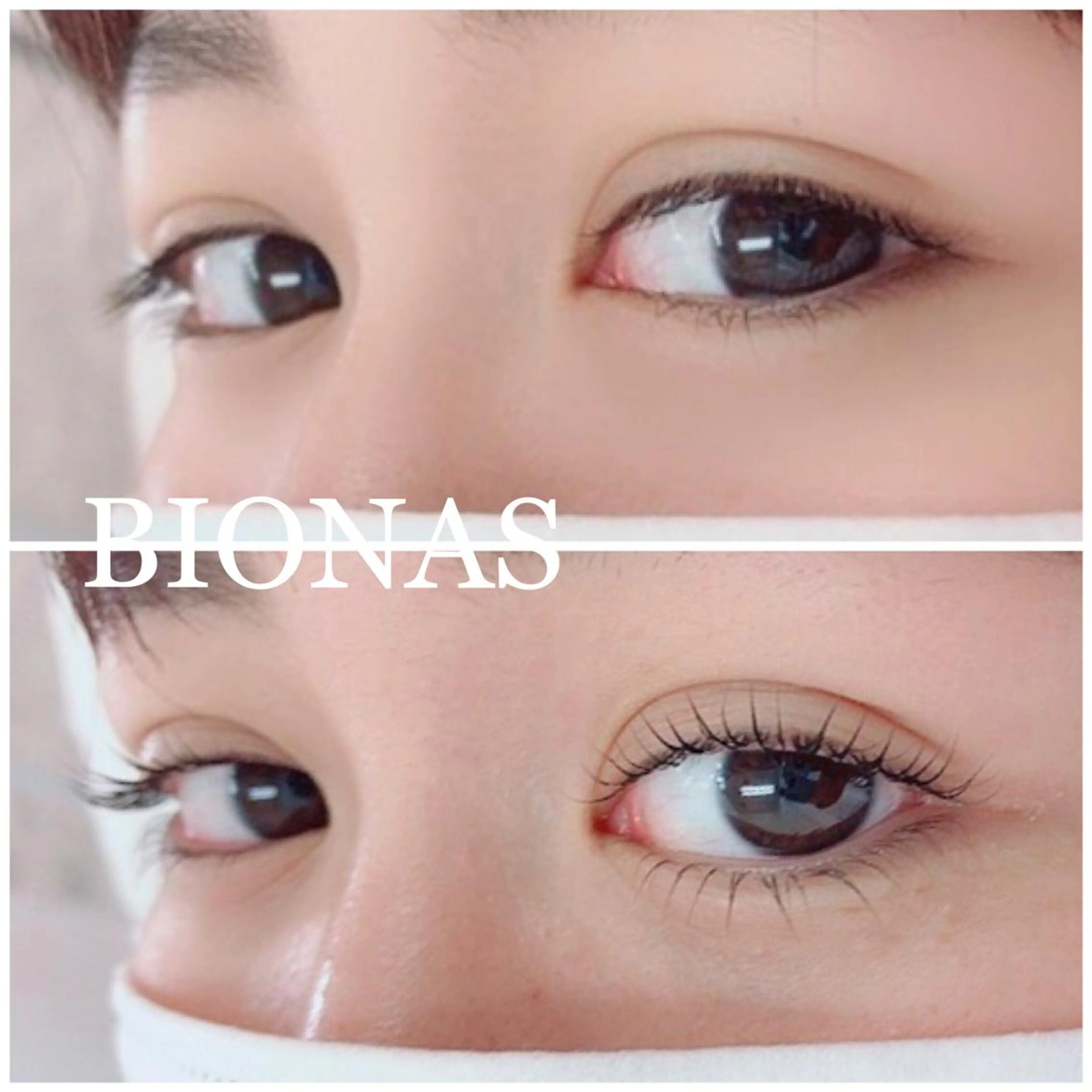 次世代ラッシュリフト上下の写真