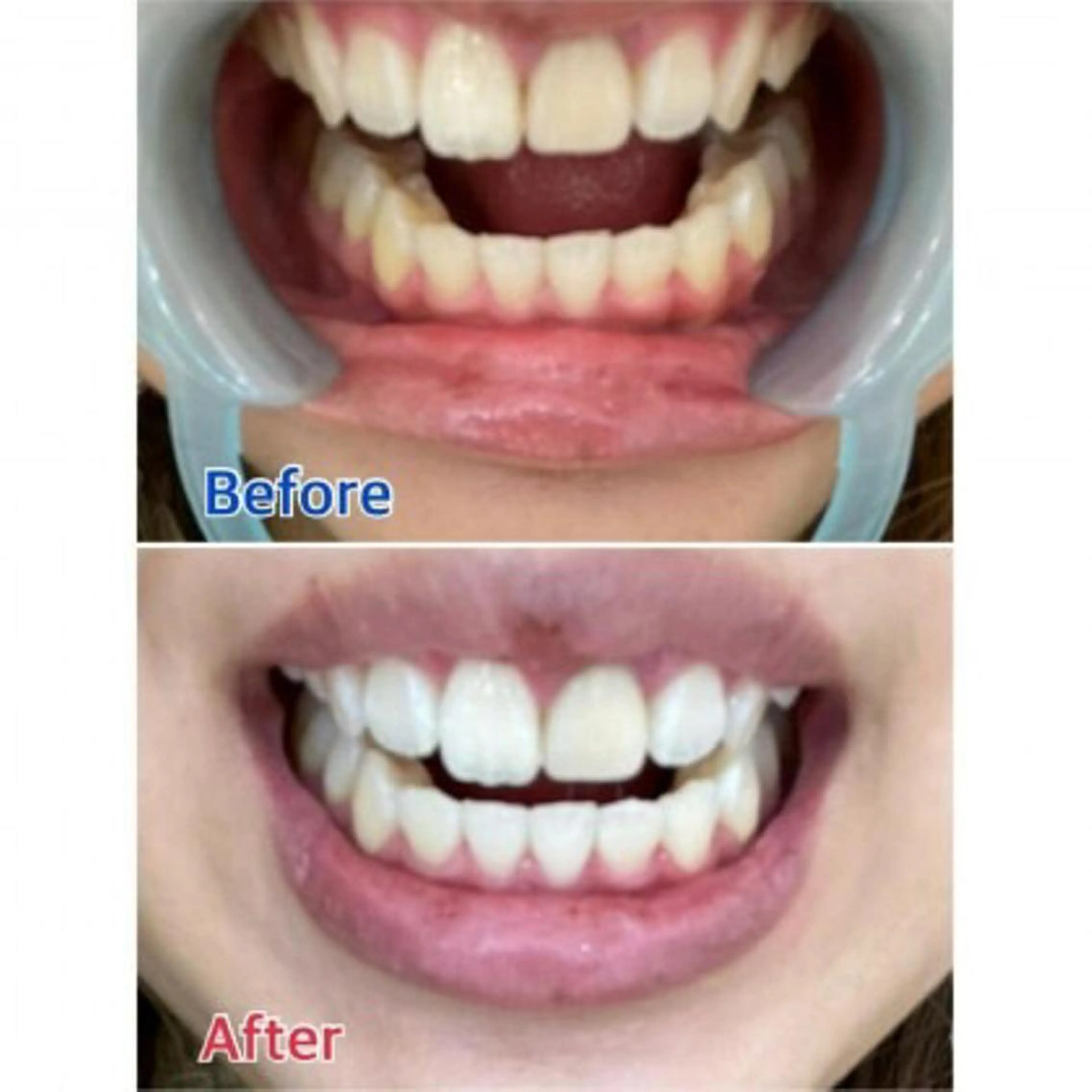 M渋谷店所属・Ｍ渋谷 ホワイトニングのエステ・リラクイメージ