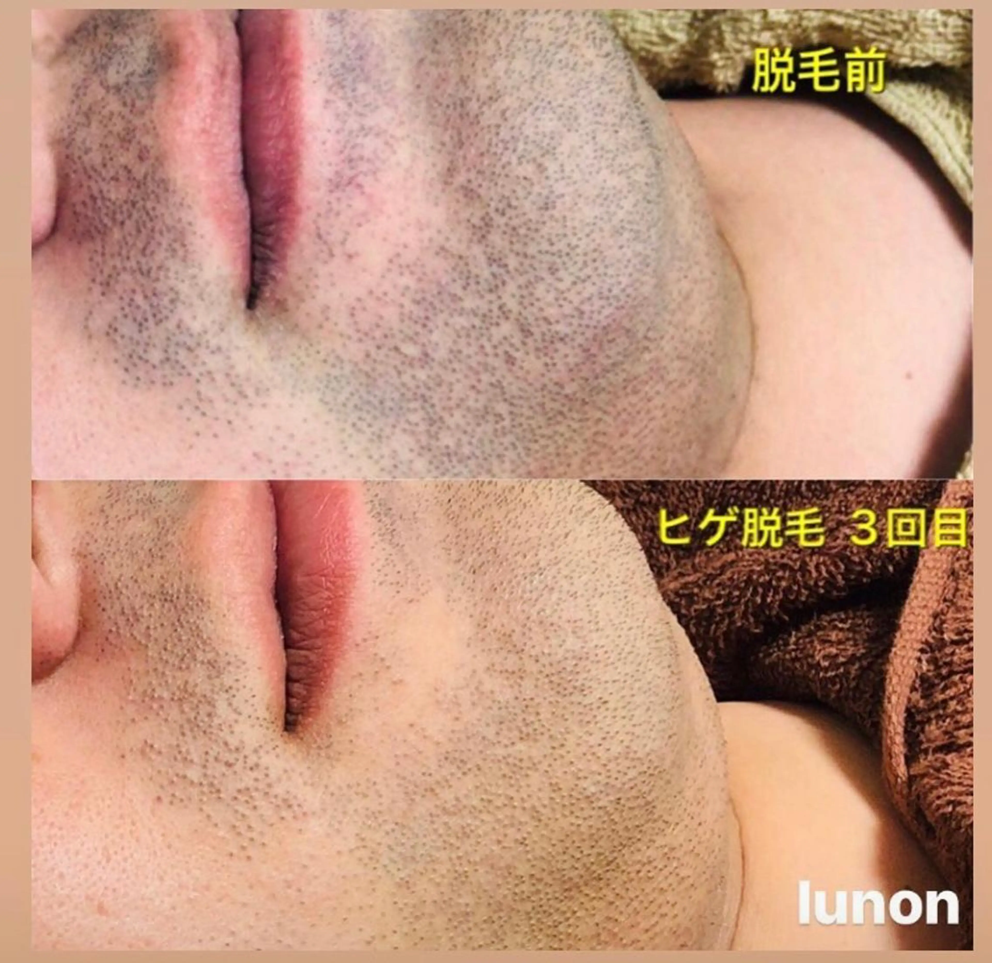 Lunon 【ルノン】のエステ・リラクイメージ