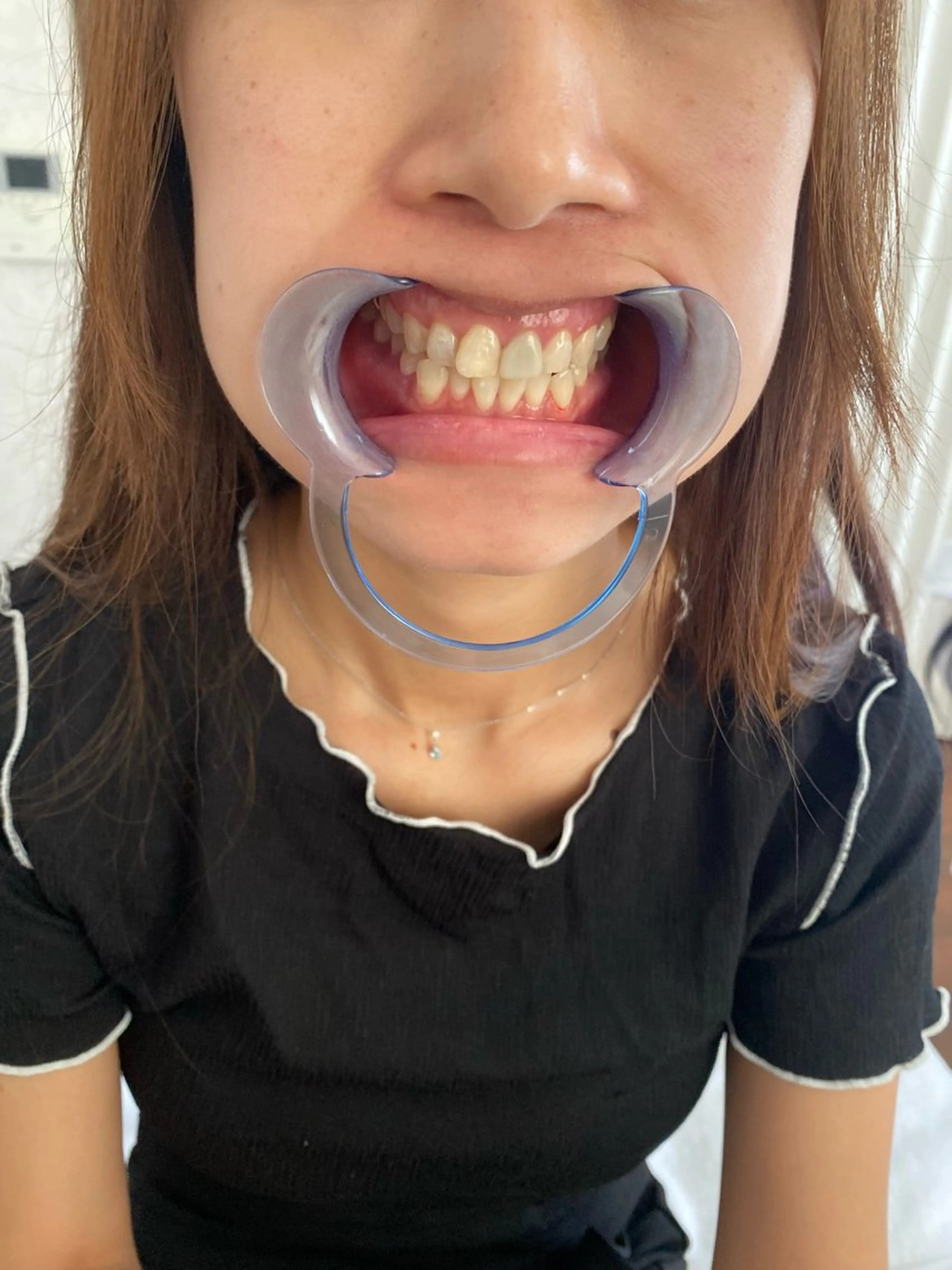 R E O T I A R A（レオティアラ）所属・高屋 昌子のその他イメージ