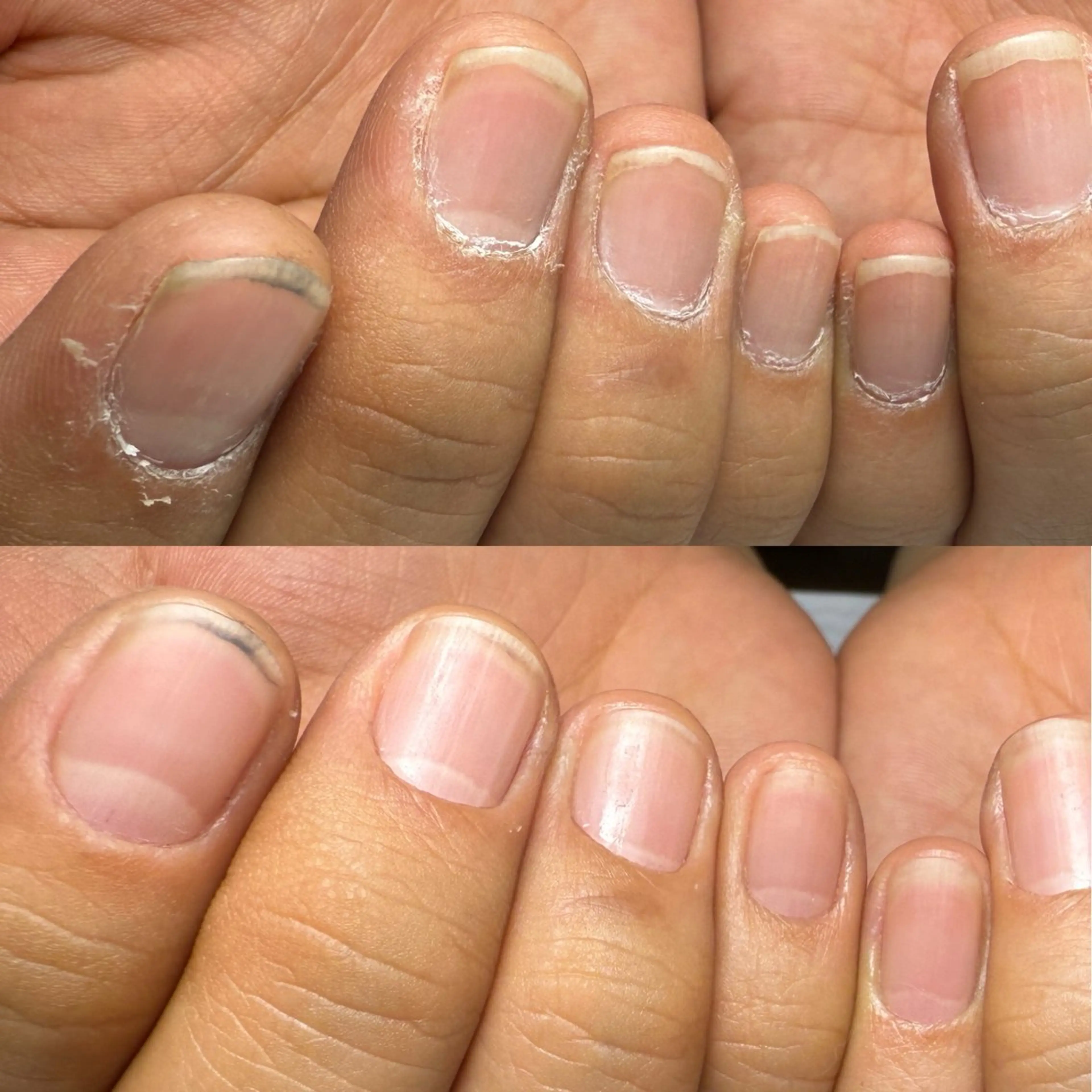 自爪をキレイに魅せる ネイルケアの写真