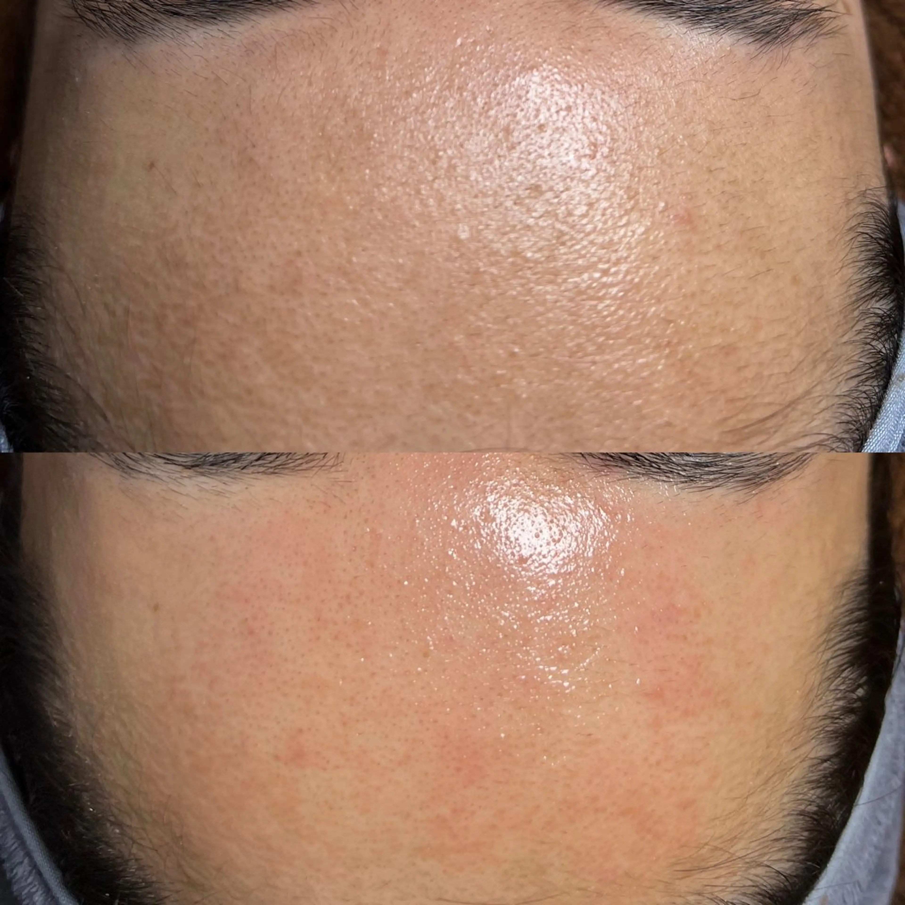 脱毛 GOLDEN AGE所属・GOLDEN AGEのエステ・リラクイメージ