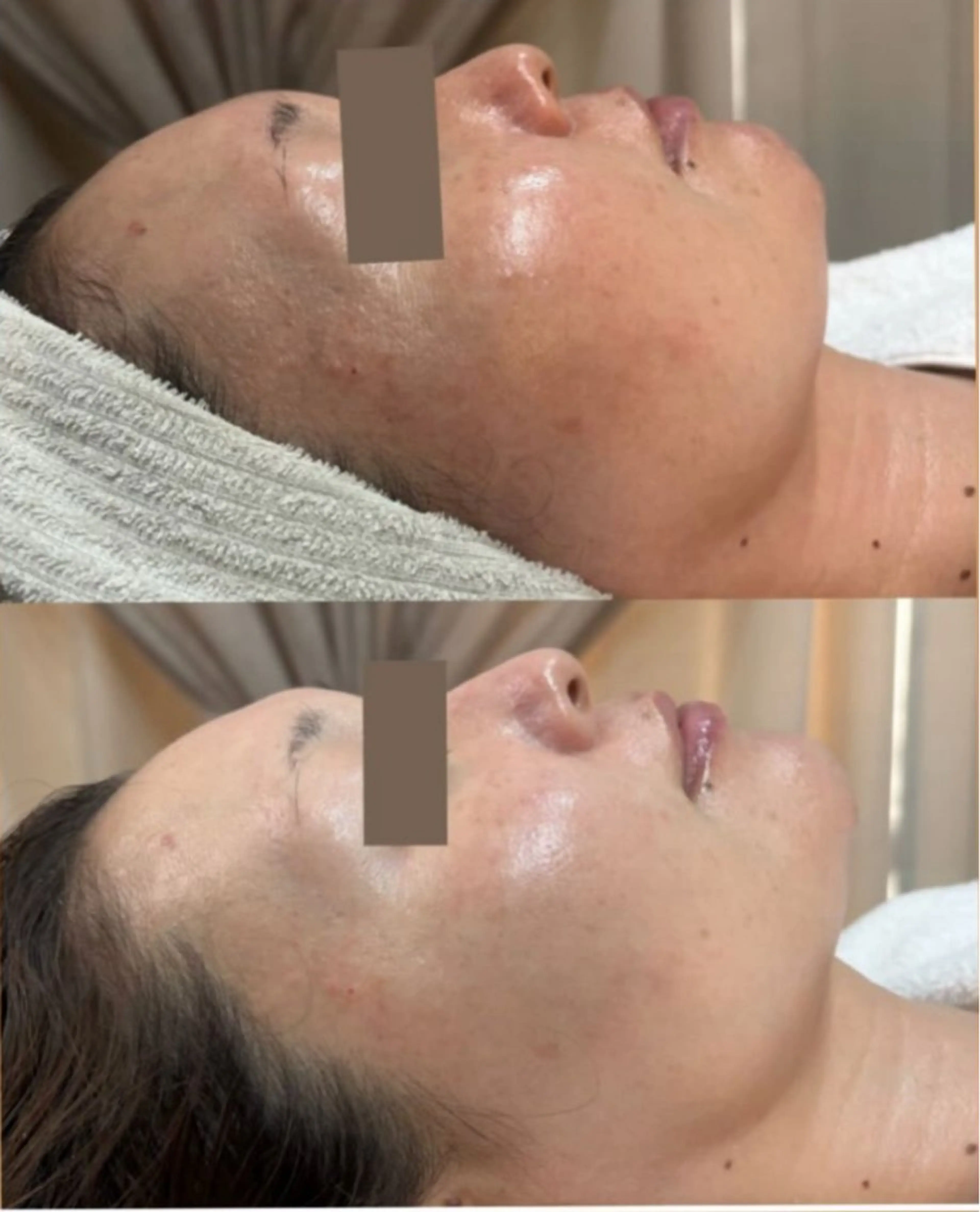 エステ Meow！～トラブル肌専門ピーリング＆脱毛サロン～所属・トラブル肌改善🏥 Meow！🫧🫧のその他イメージ