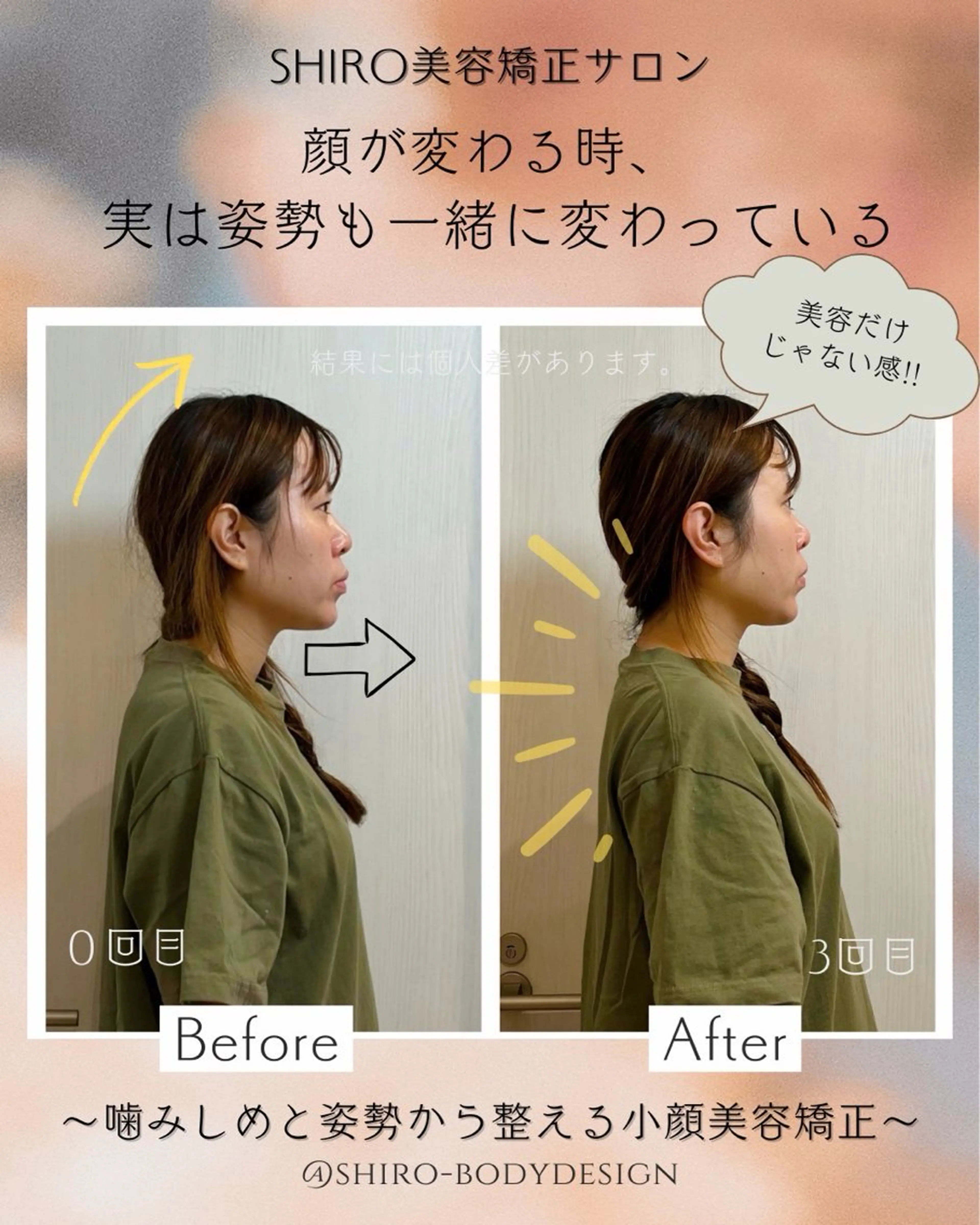小顔美容矯正勝山式 shiroしろのエステ・リラクイメージ