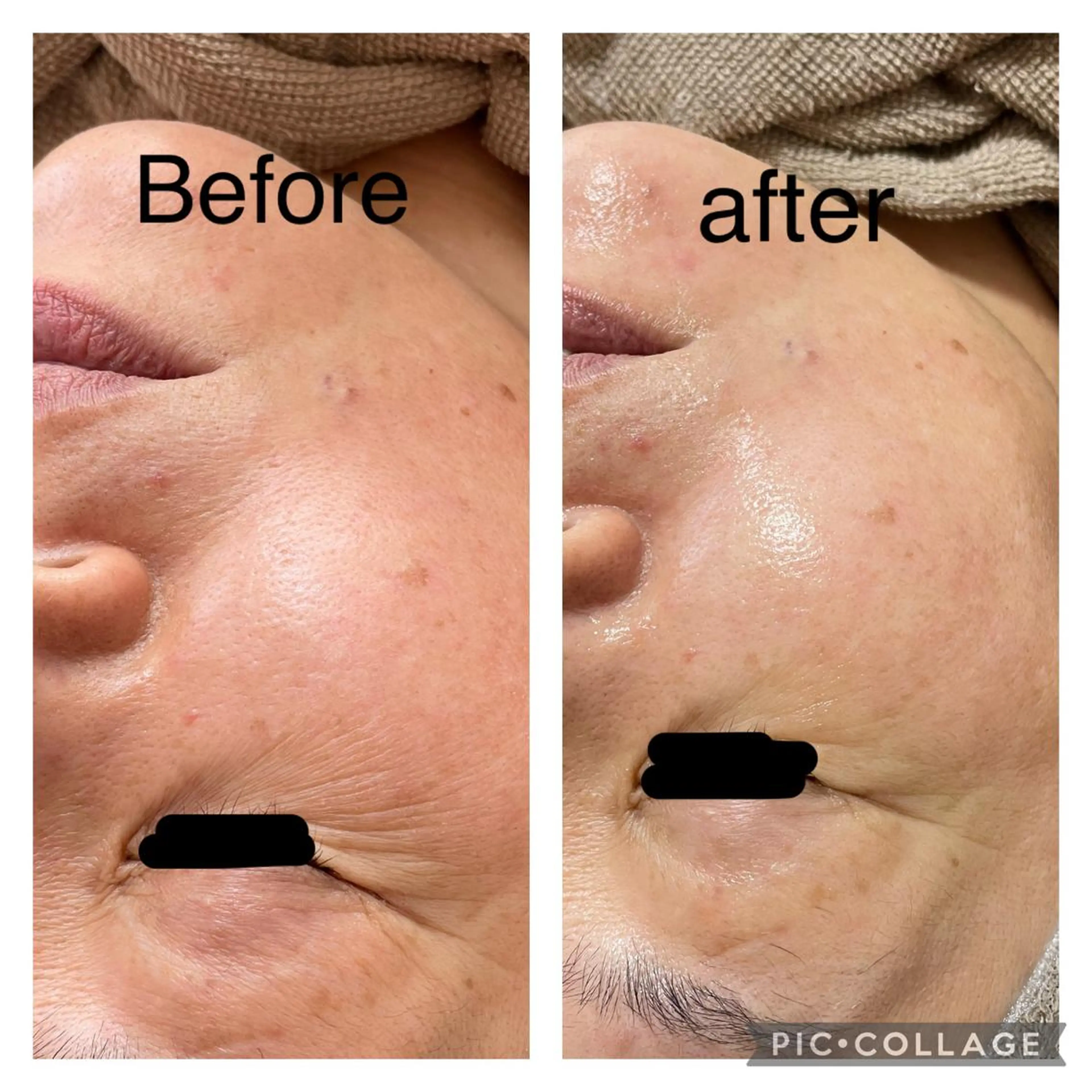 エステ リラク ECXIA ｴｸｼｱのエステ・リラクイメージ