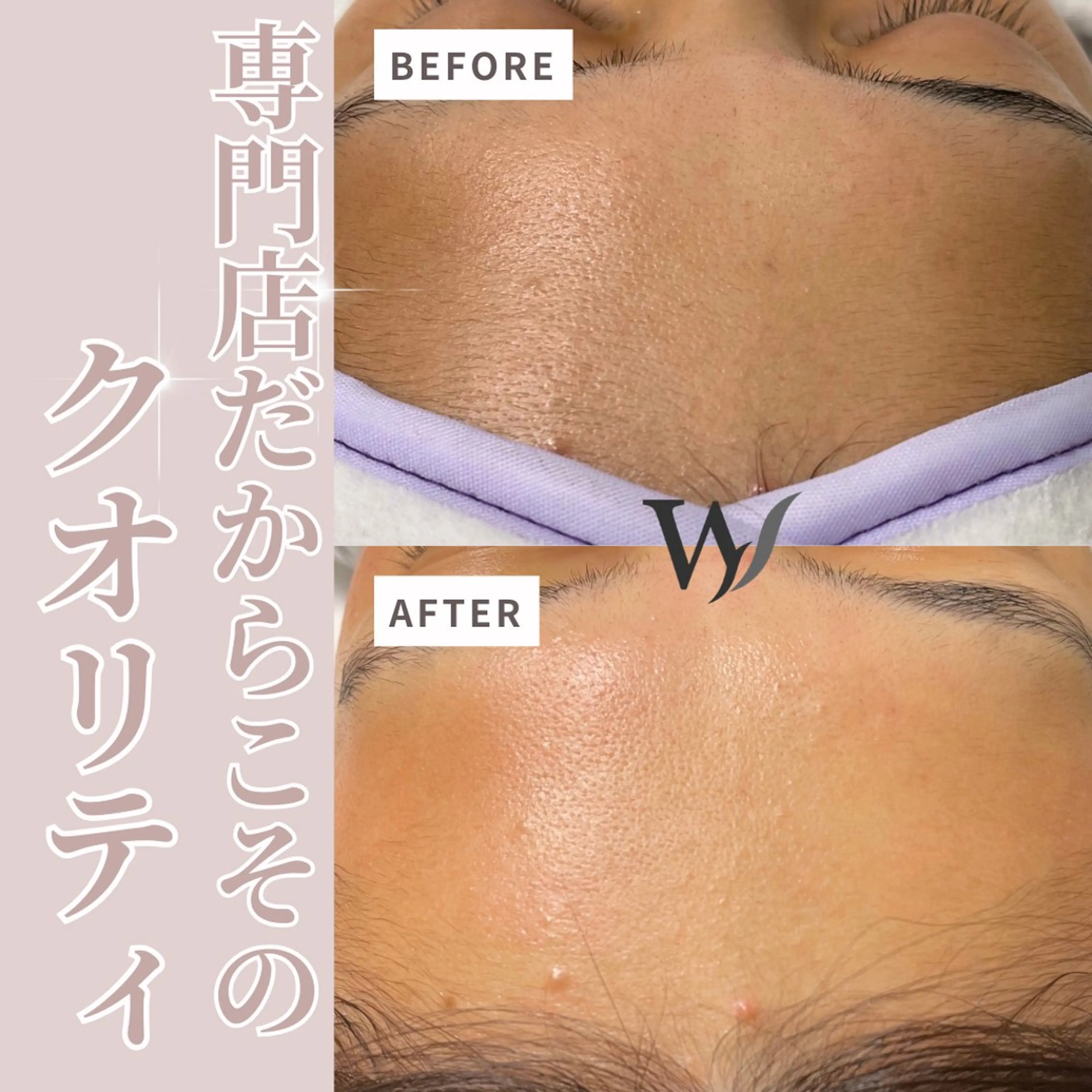 メンズ ホワイトワックス名古屋金山店所属・ホワイトワックス 金山店のエステ・リラクイメージ