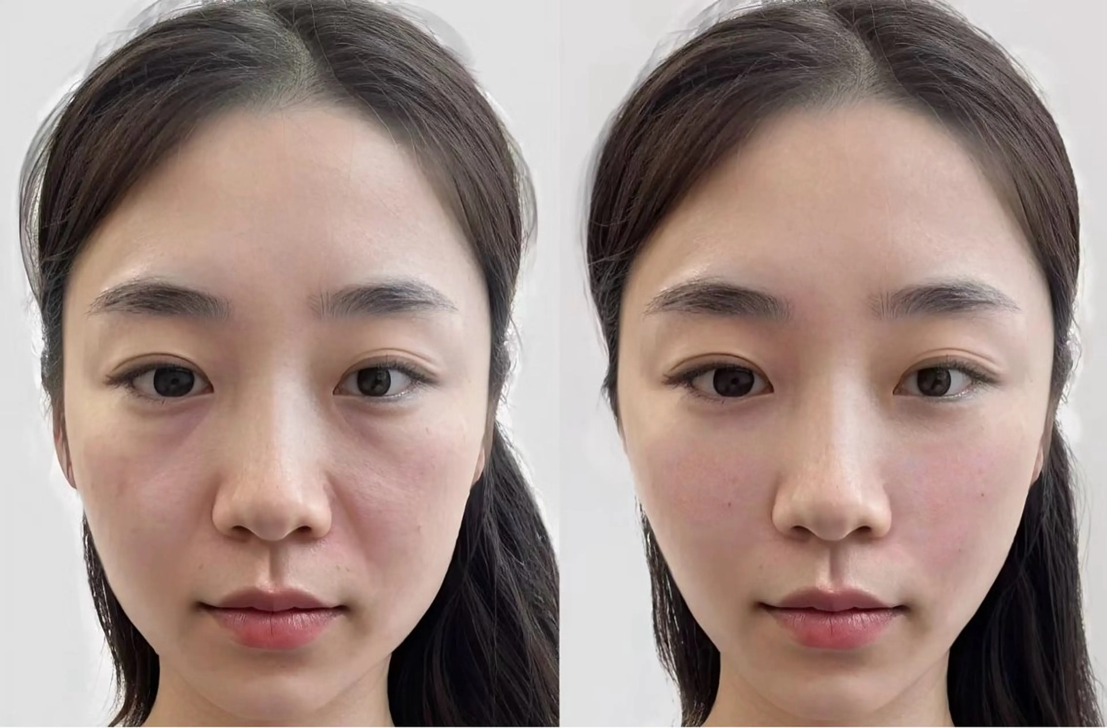 マツエク・マツパ エステ aliaハイフ&水光ジェットサロン所属・aliaハーブ水光店 エステティシャン募集のエステ・リラクイメージ