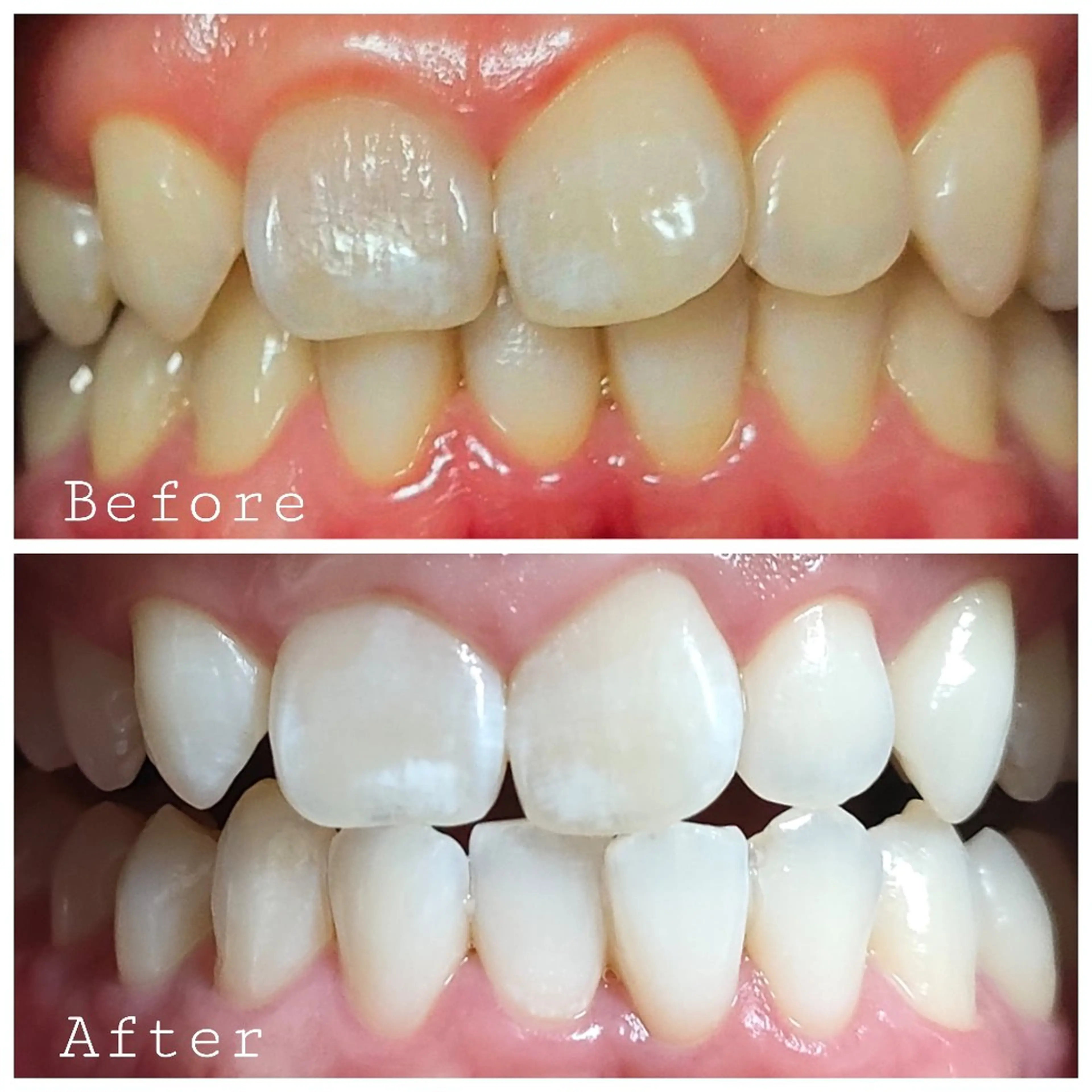 ほわいと あざぶのマツエク・マツパデザイン