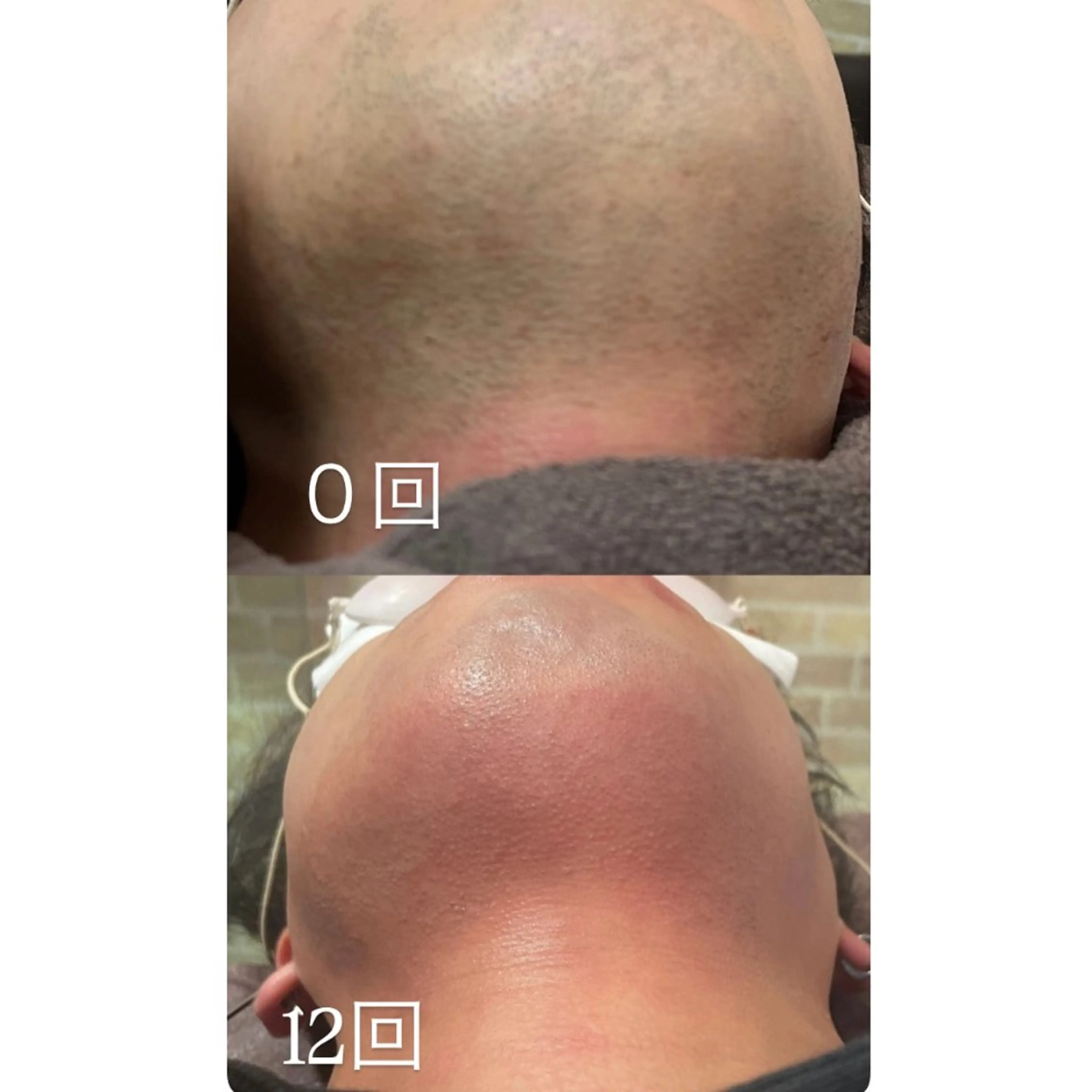 津田沼店 Earthのエステ・リラクイメージ