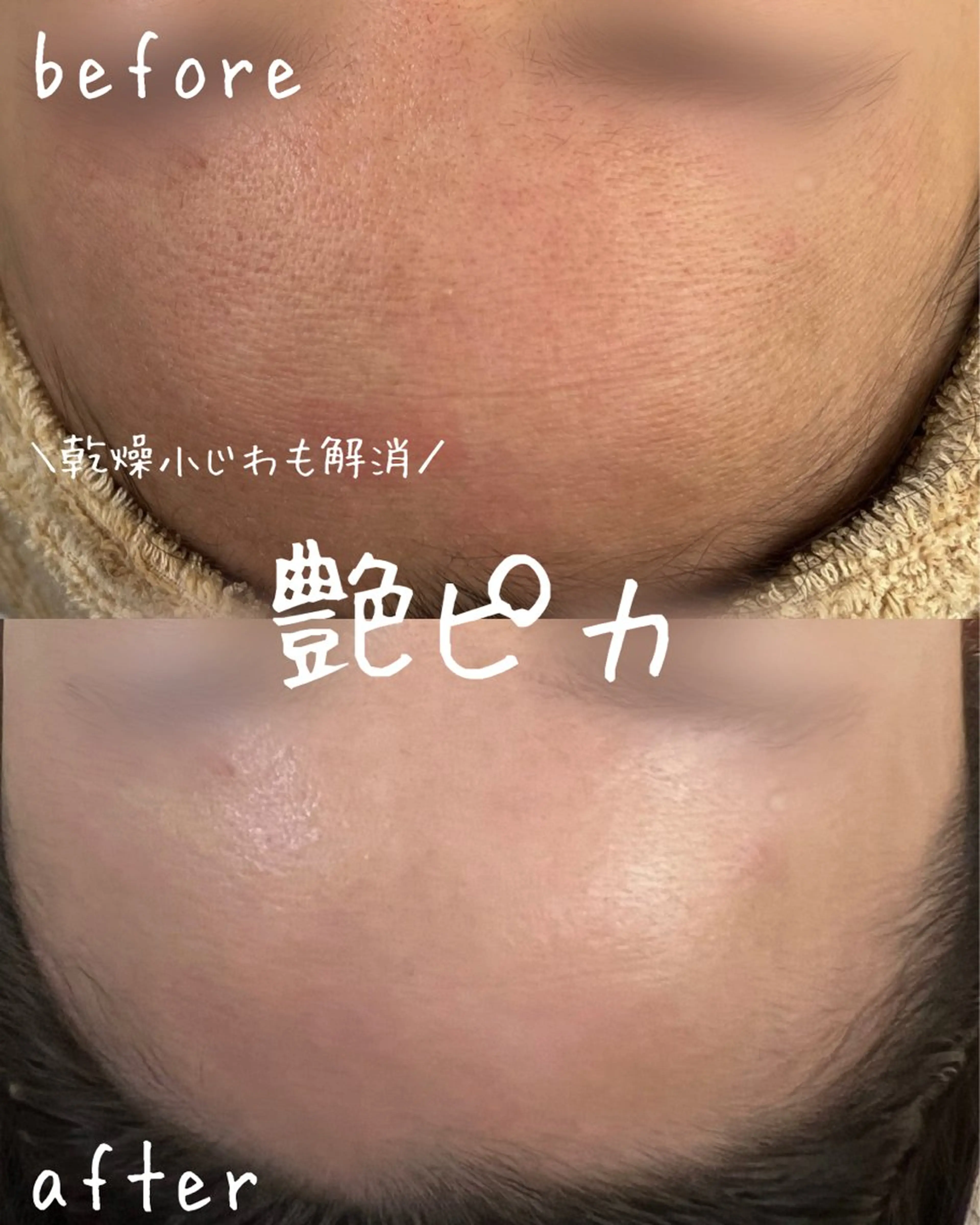 エステ miki 東根の肌質改善サロンのエステ・リラクイメージ