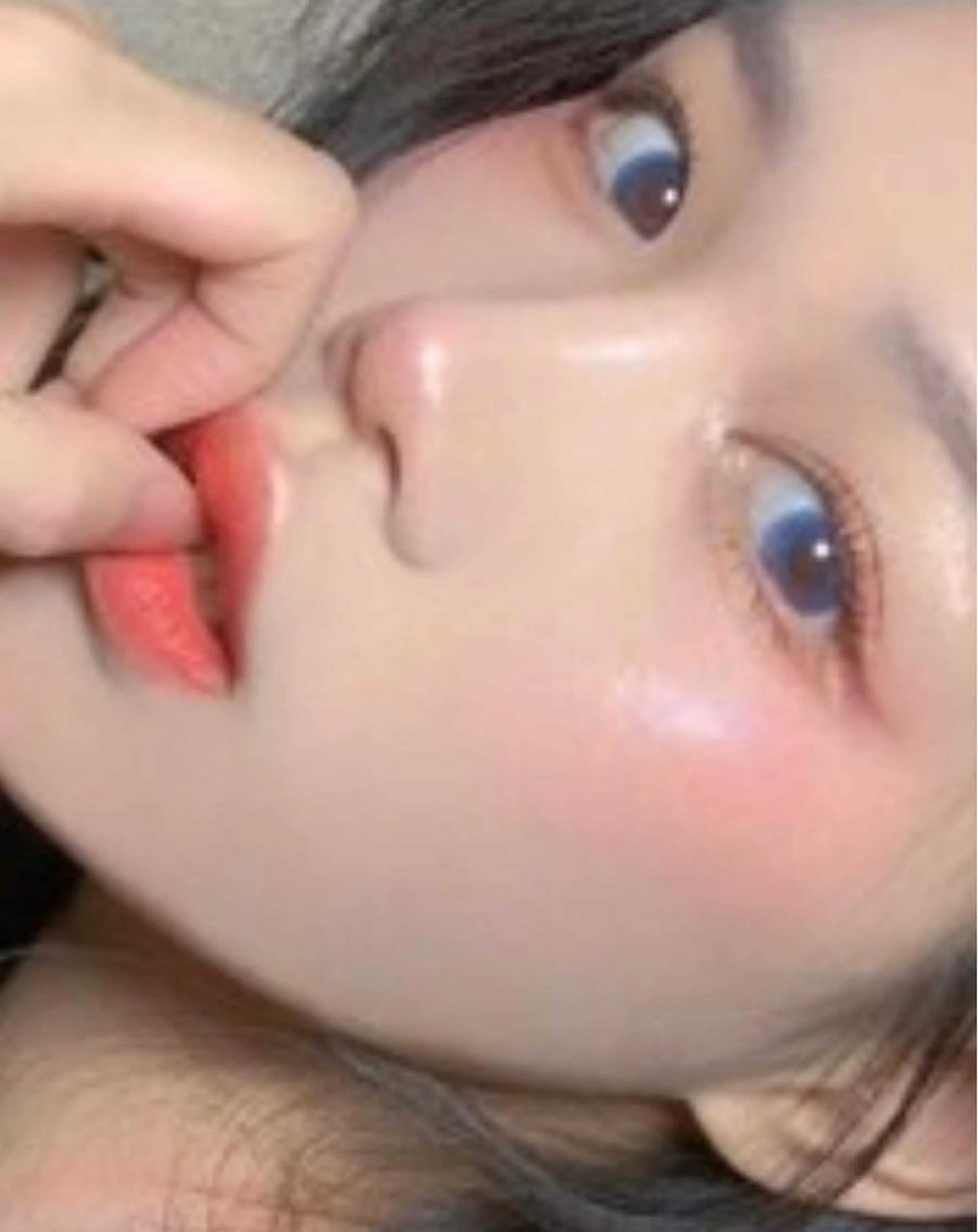 最新機器！！ジェル不要の光速施術！脱毛Mパーツの写真