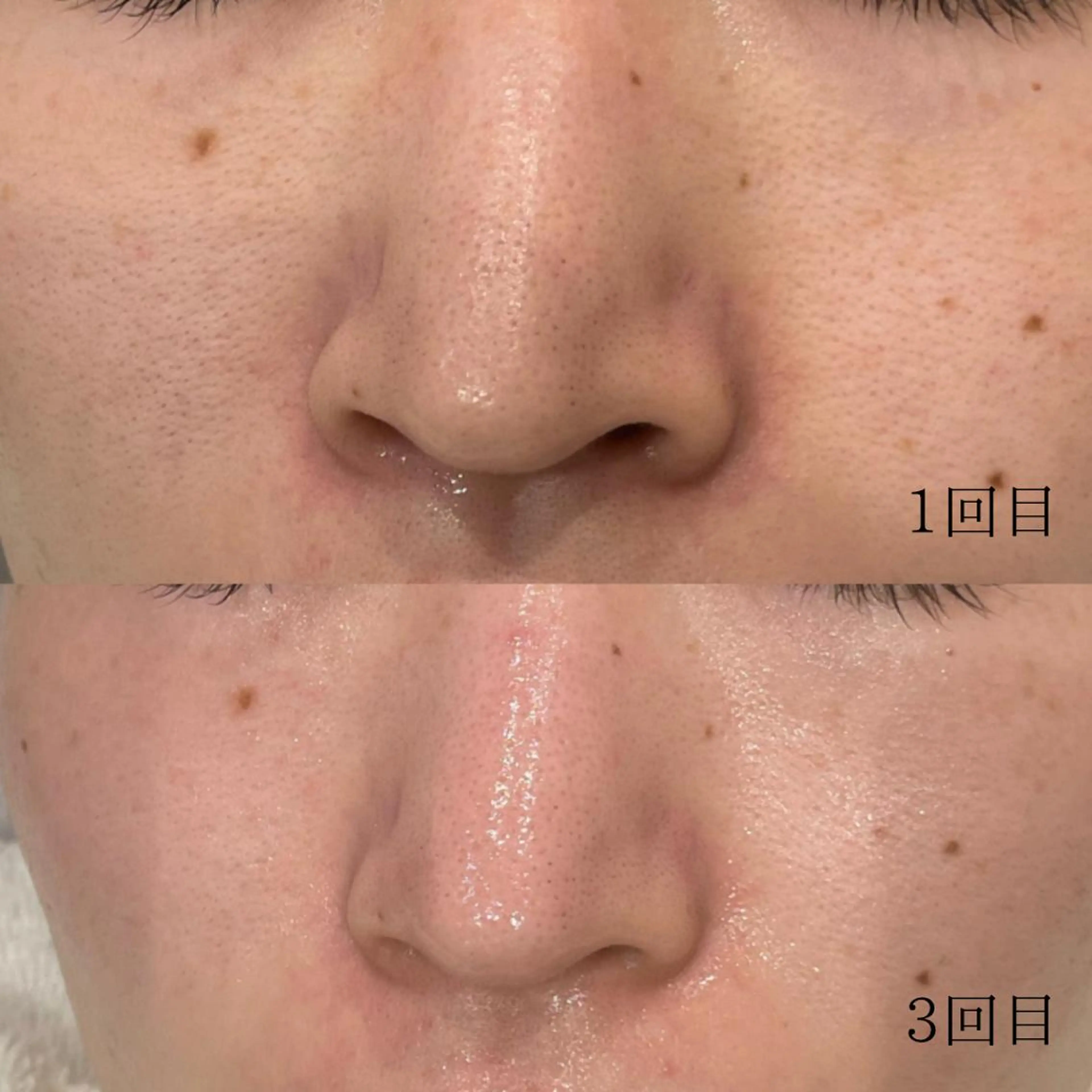 エステ リラク DeI'm   名古屋栄所属・小林 玲菜のエステ・リラクイメージ