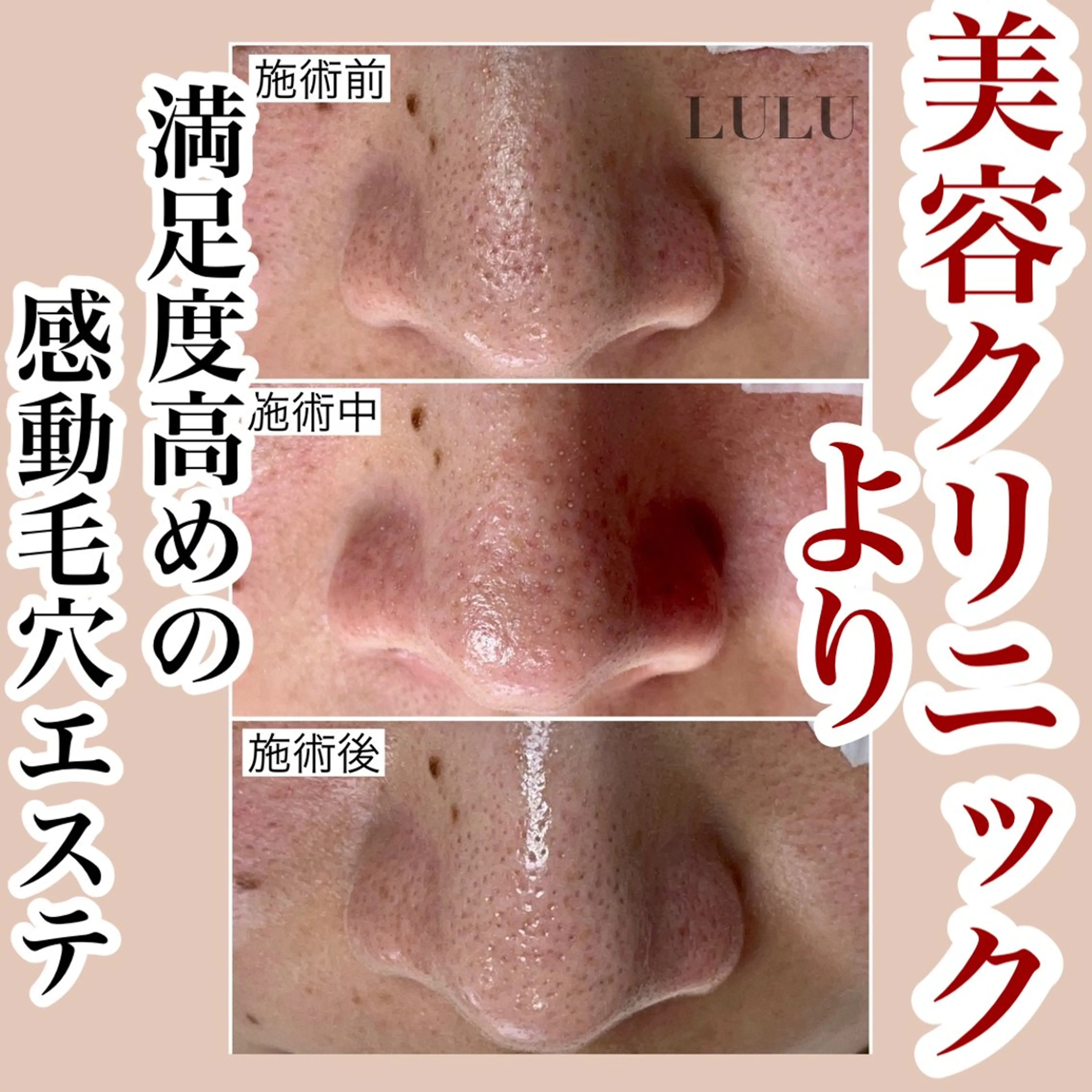 LULU所属・LULU ルルのエステ・リラクイメージ