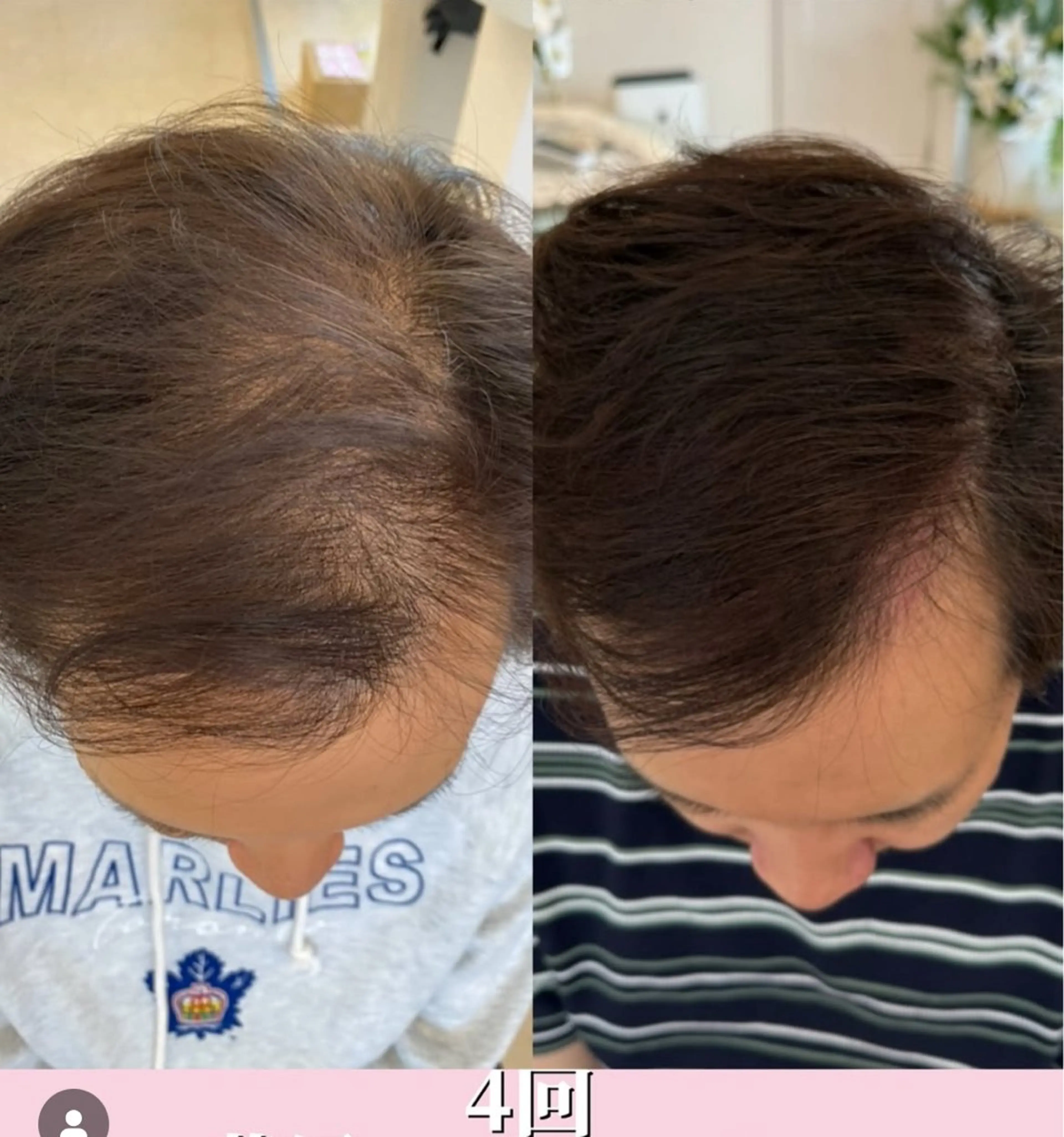 メンズ Blooming所属・LOUISE. ／肌質・頭皮のエステ・リラクイメージ