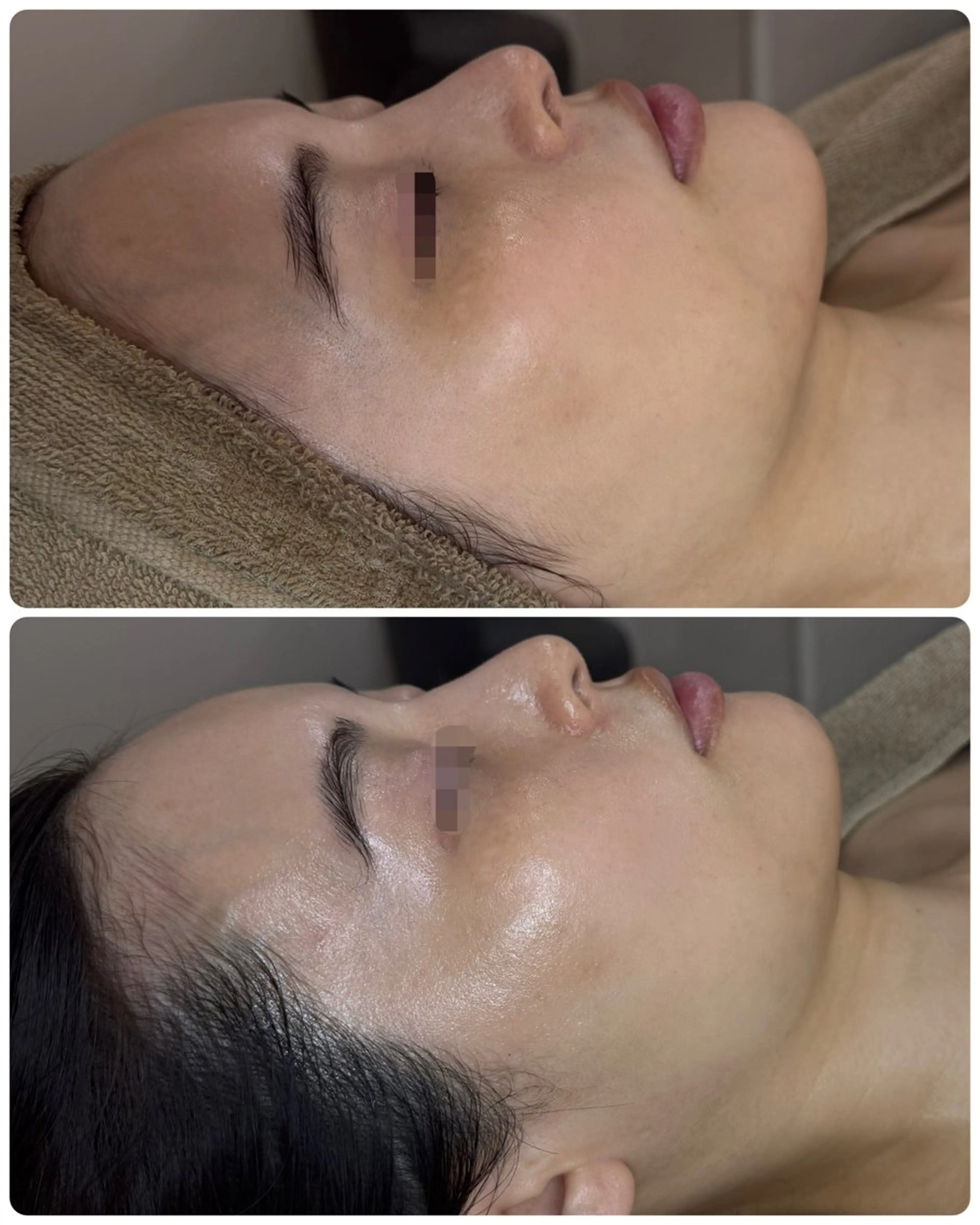 エステ 【ハーブピーリング/韓国ツヤ肌ピーリング】RelierBelle-ルリエベル-所属・肌質改善/肌育特化 プライベートサロンのエステ・リラクイメージ