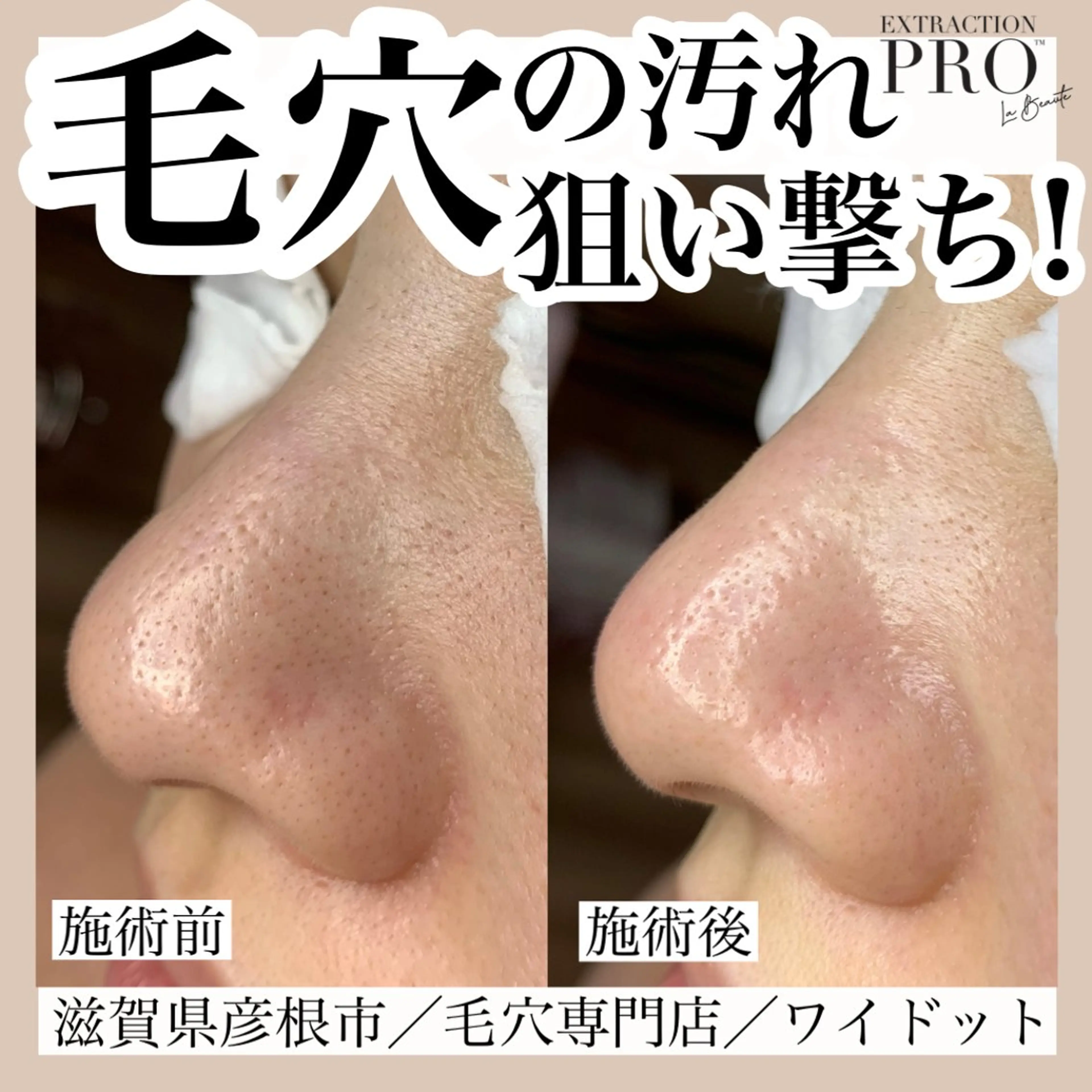 エステ Ydot. 池内 友架のエステ・リラクイメージ