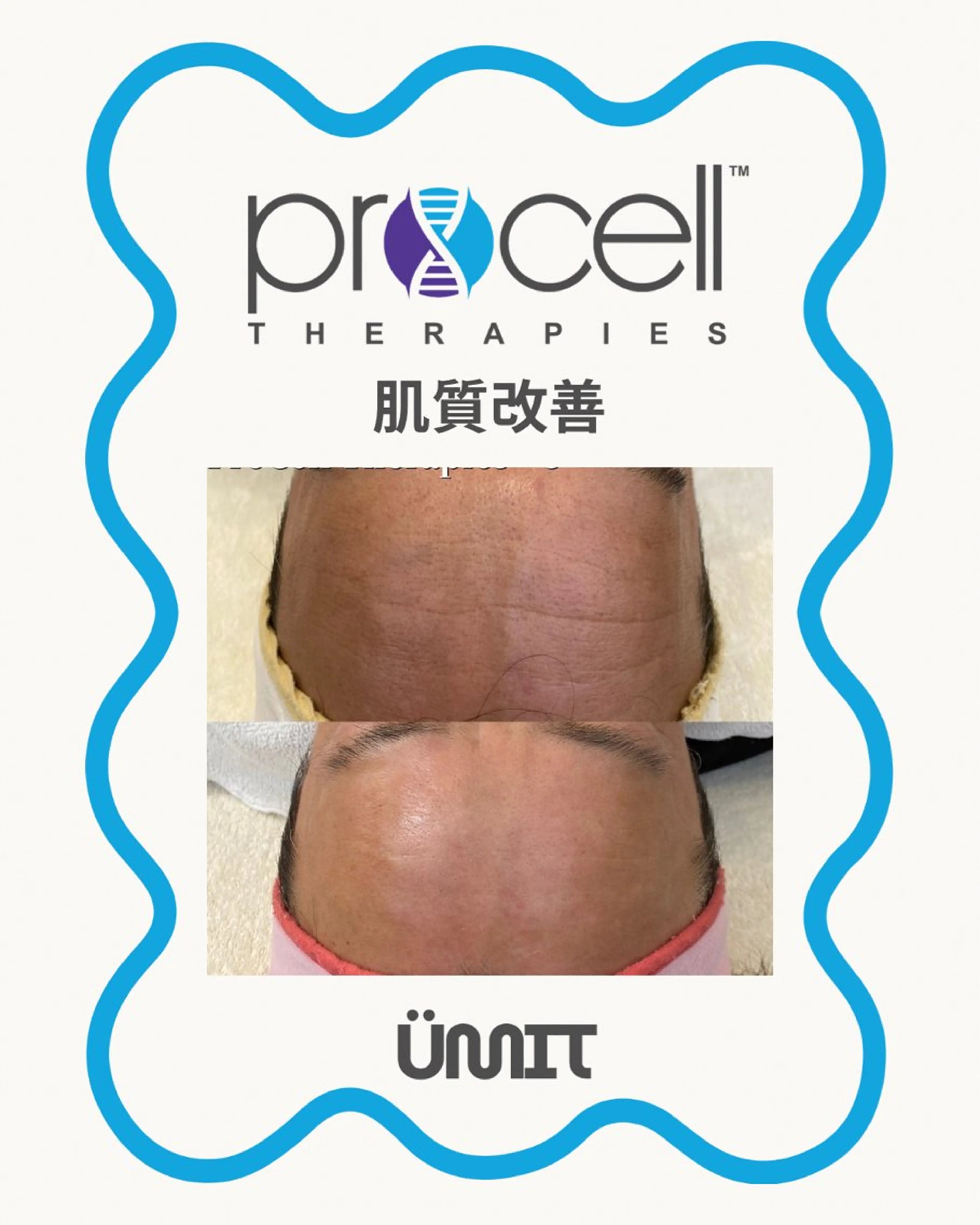 エステ Ümit（ユミト） プロセルセラピーズのネイルデザイン