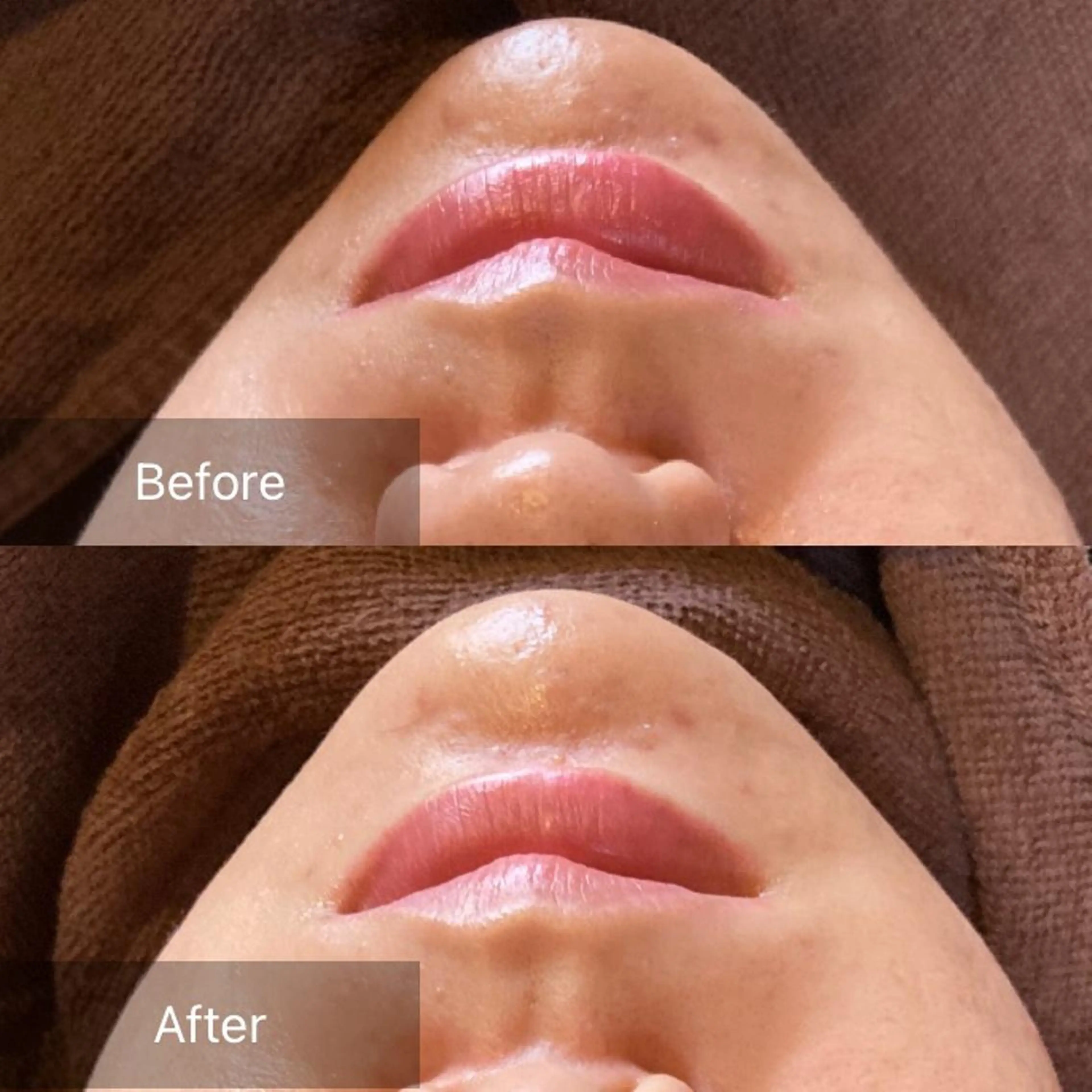 エステ 産毛専門店 Bittoのエステ・リラクイメージ