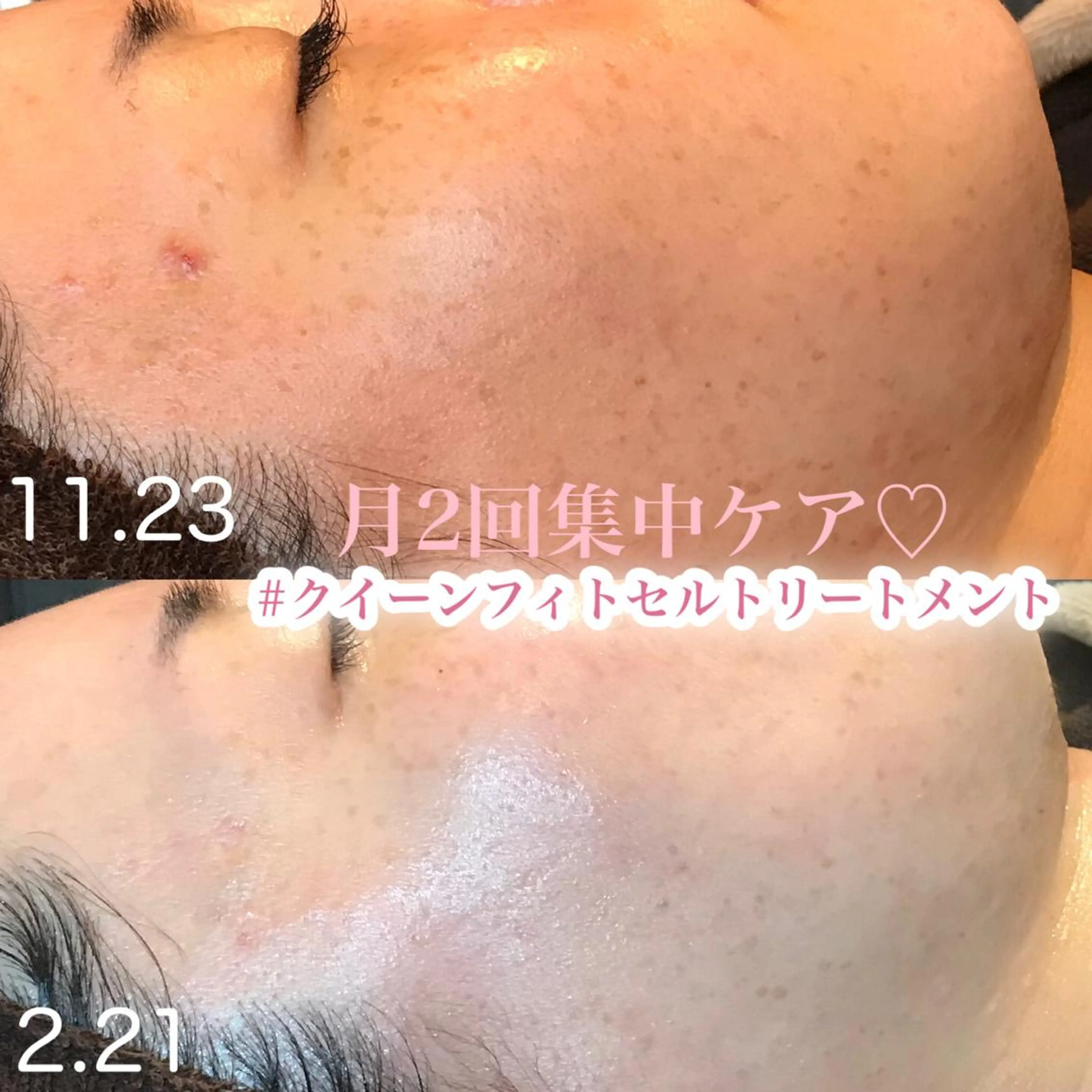 エステ 浜野 恵美のエステ・リラクイメージ