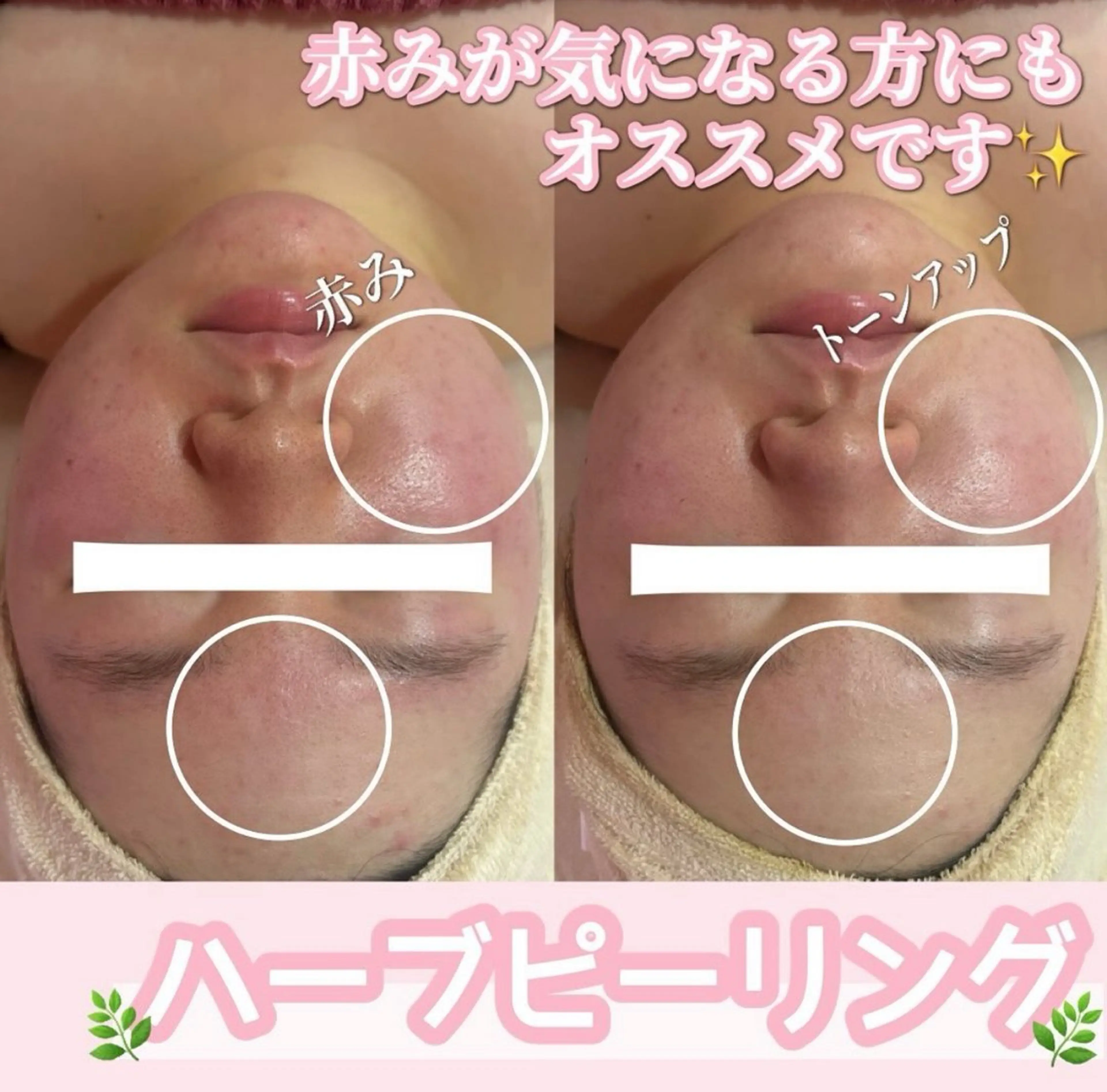 エステ SALON所属・SALON韓国肌管理 東別院のエステ・リラクイメージ