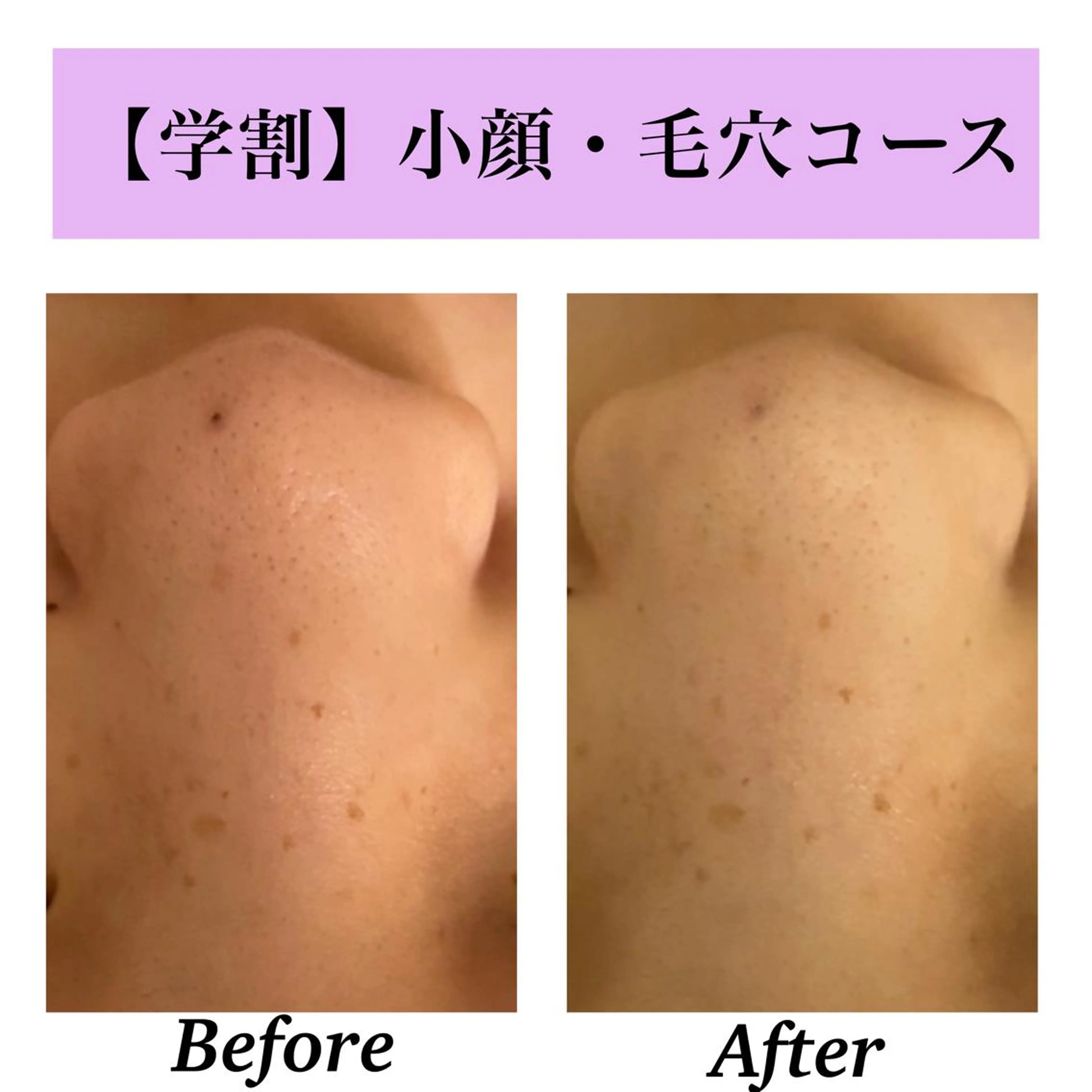 Bellesthe （ベルエステ）のエステ・リラクイメージ