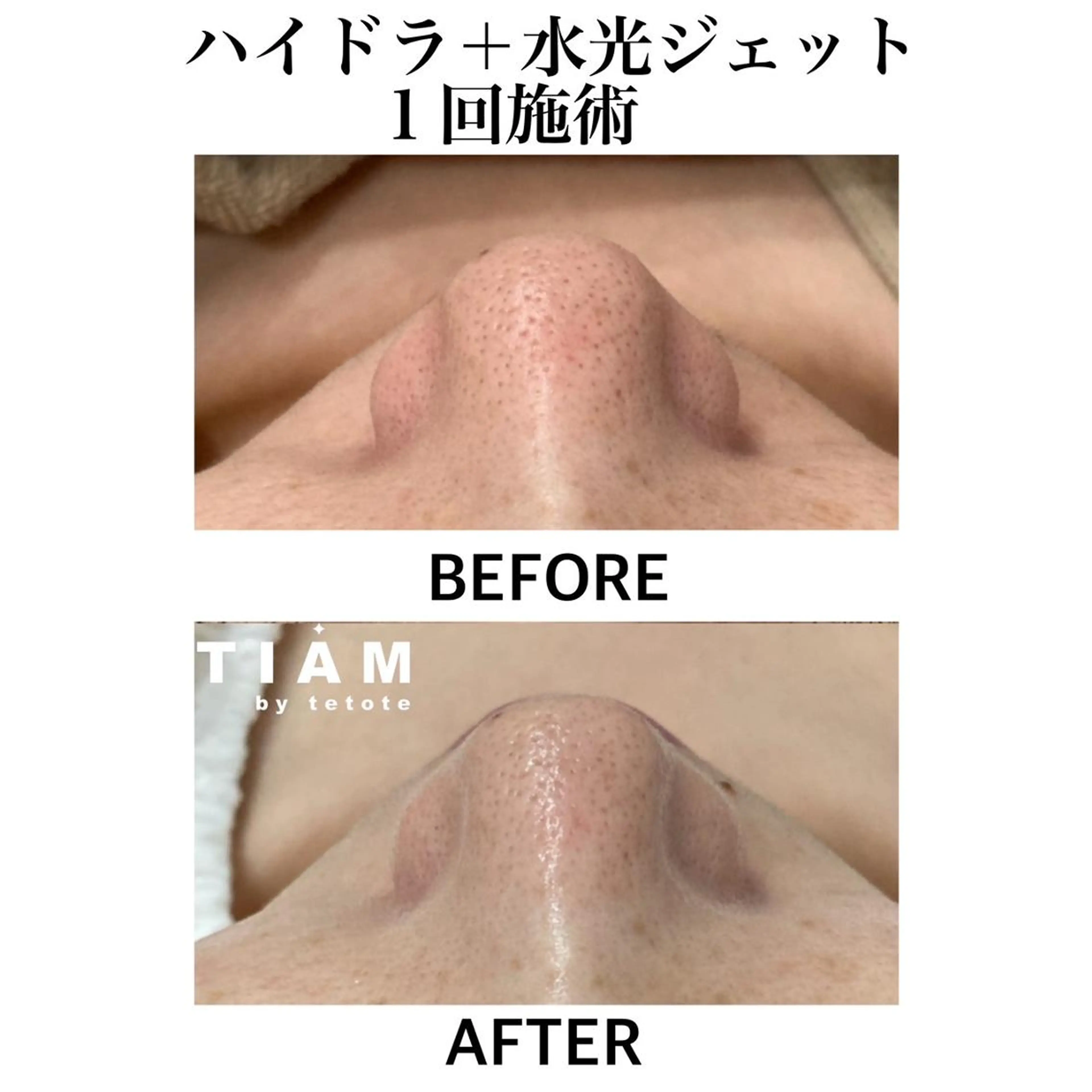 美肌サロンTIAM by tetoteのエステ・リラクイメージ