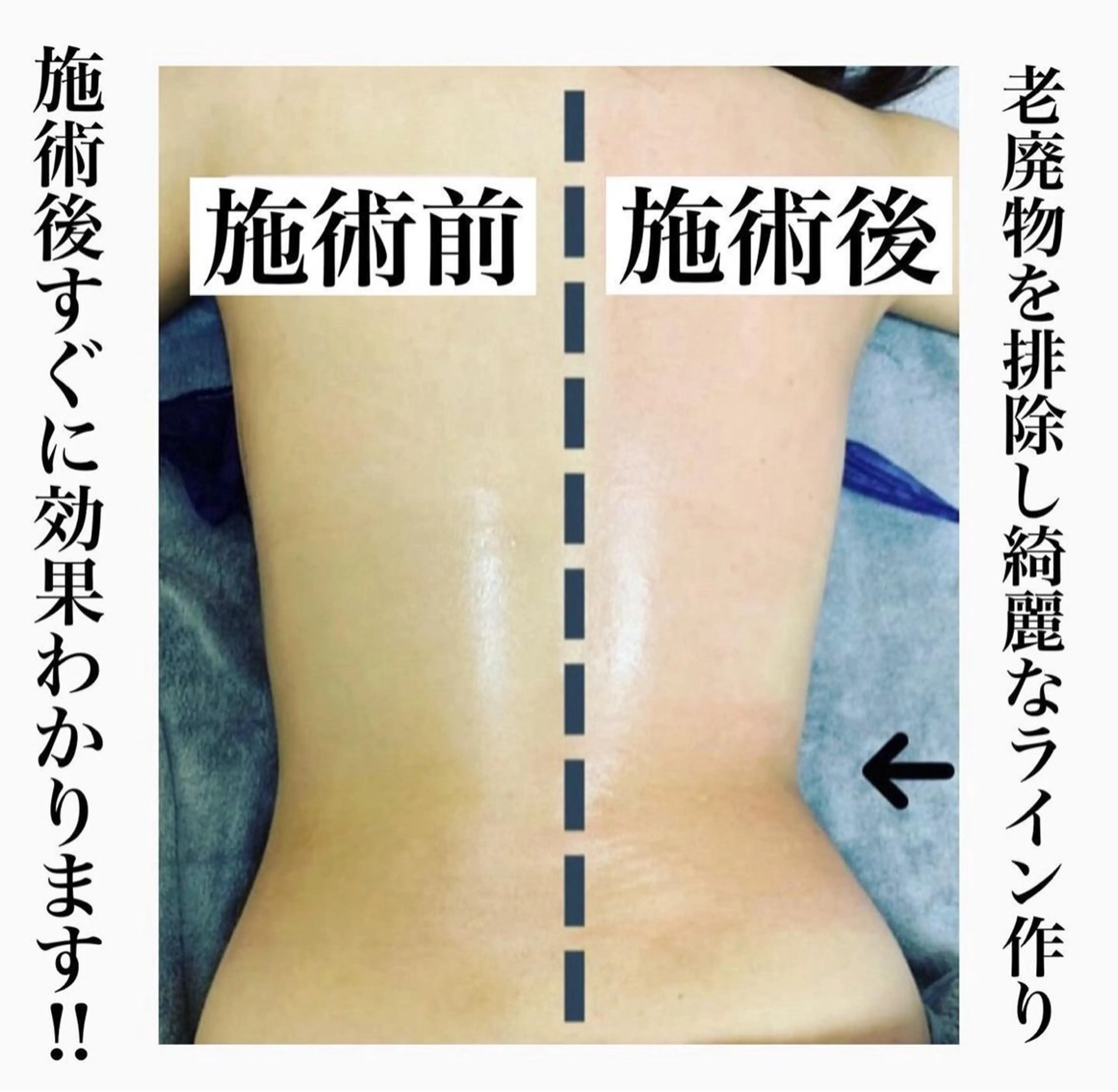 エステ Beauty SalonEclatのエステ・リラクイメージ