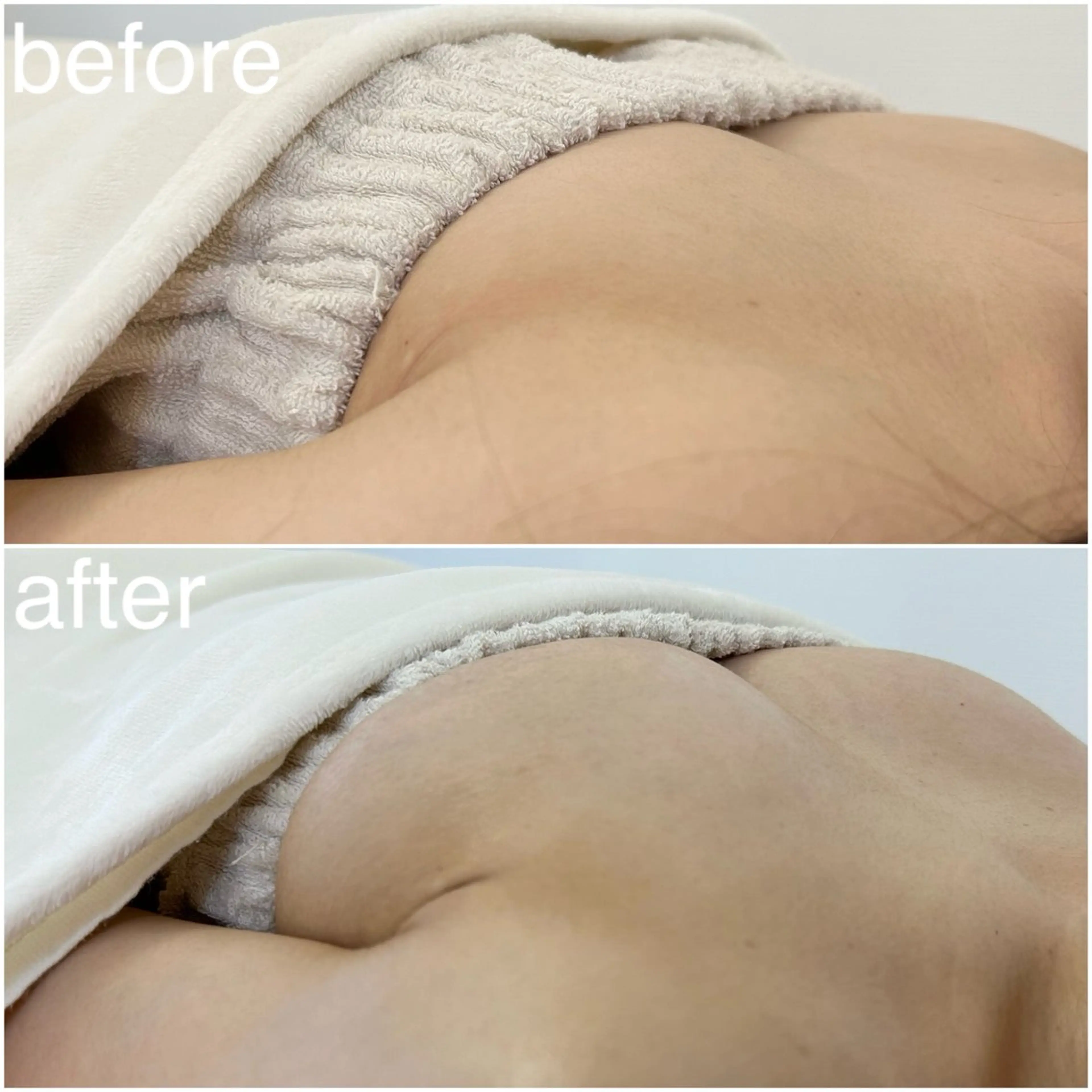 バスト/腸もみ/美肌 サロンLelalaのエステ・リラクイメージ