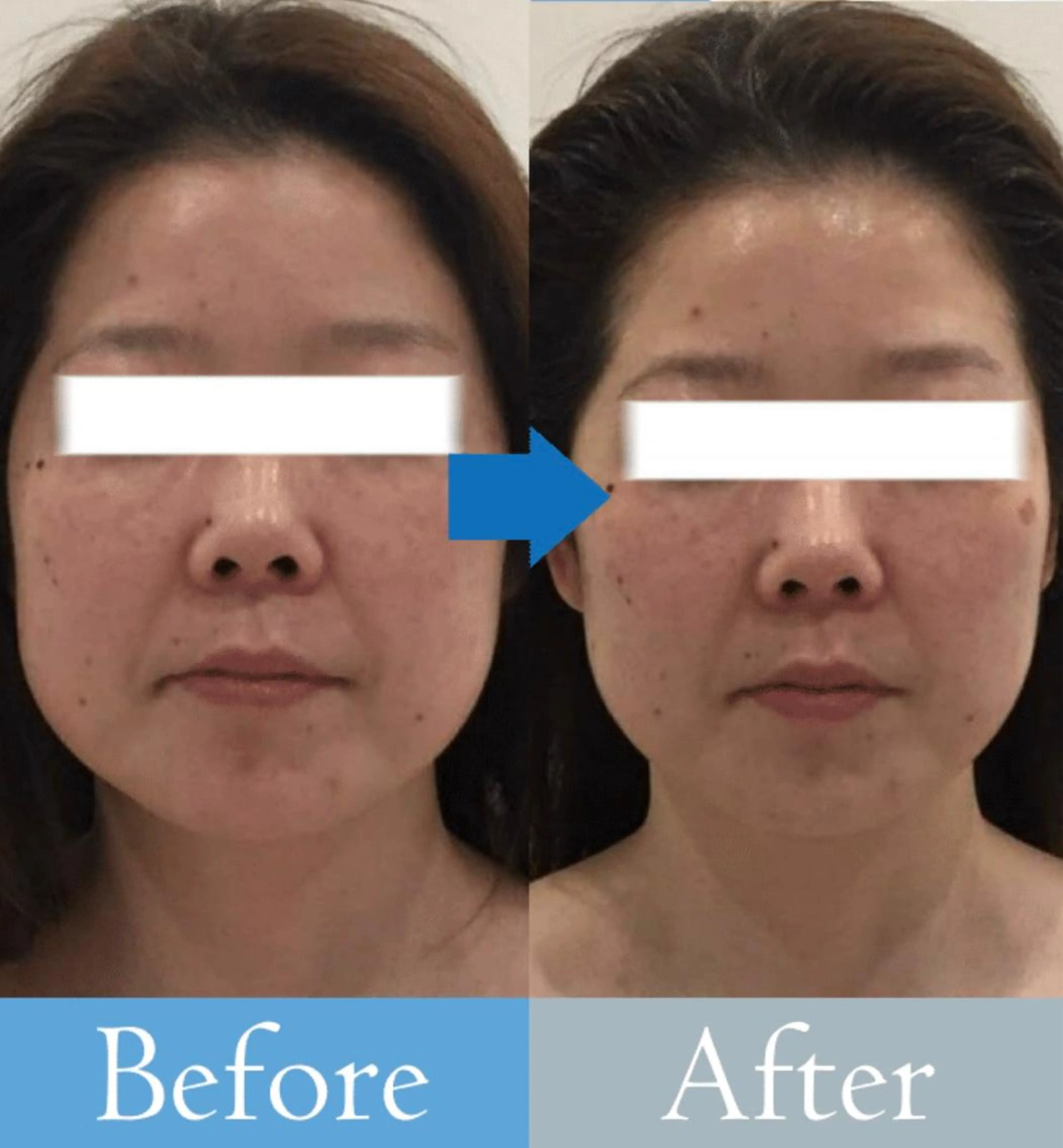 美肌/小顔/眉毛の 専門店 ルミナスのマツエク・マツパデザイン