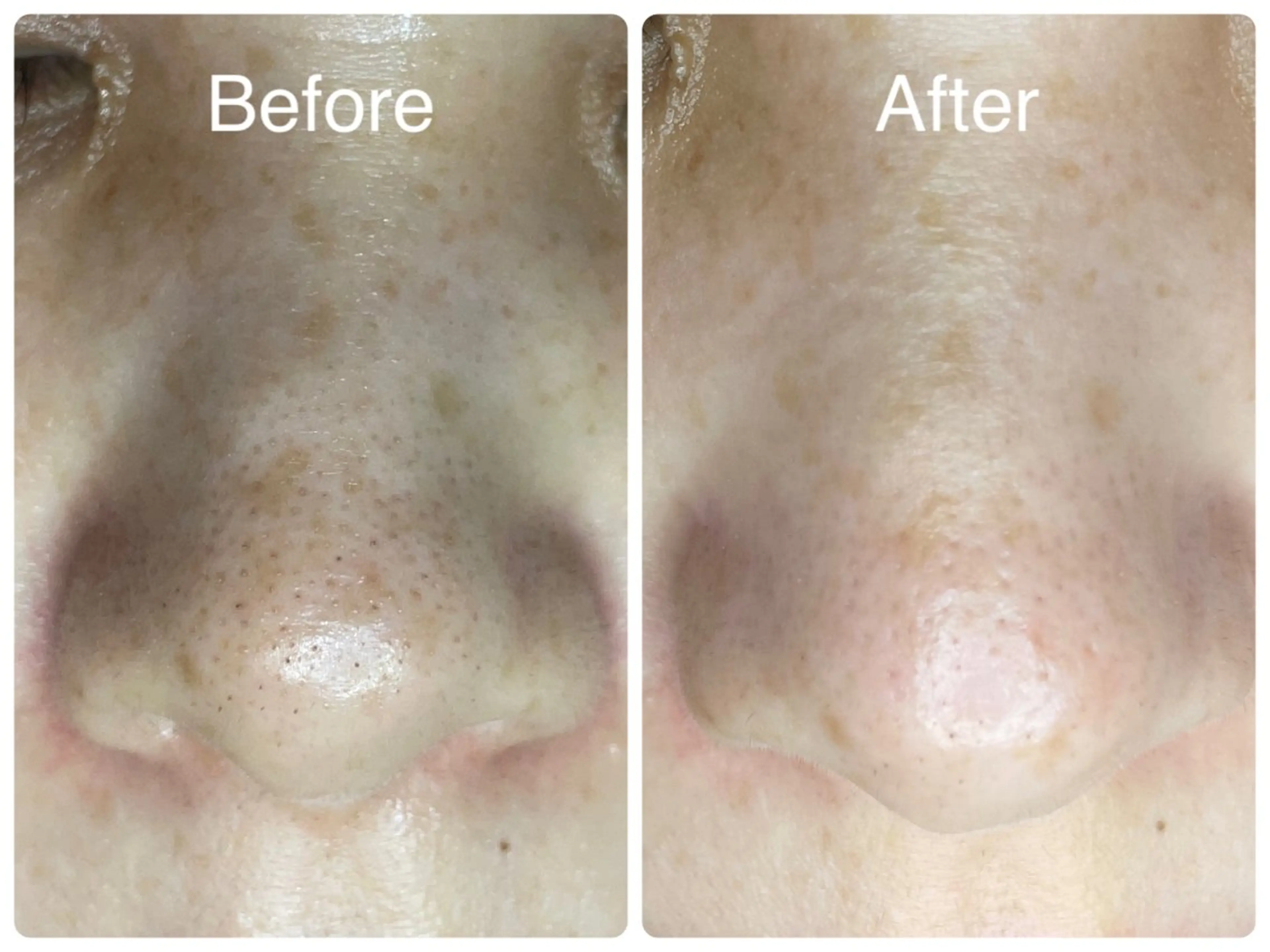 エステ salon HATOのエステ・リラクイメージ