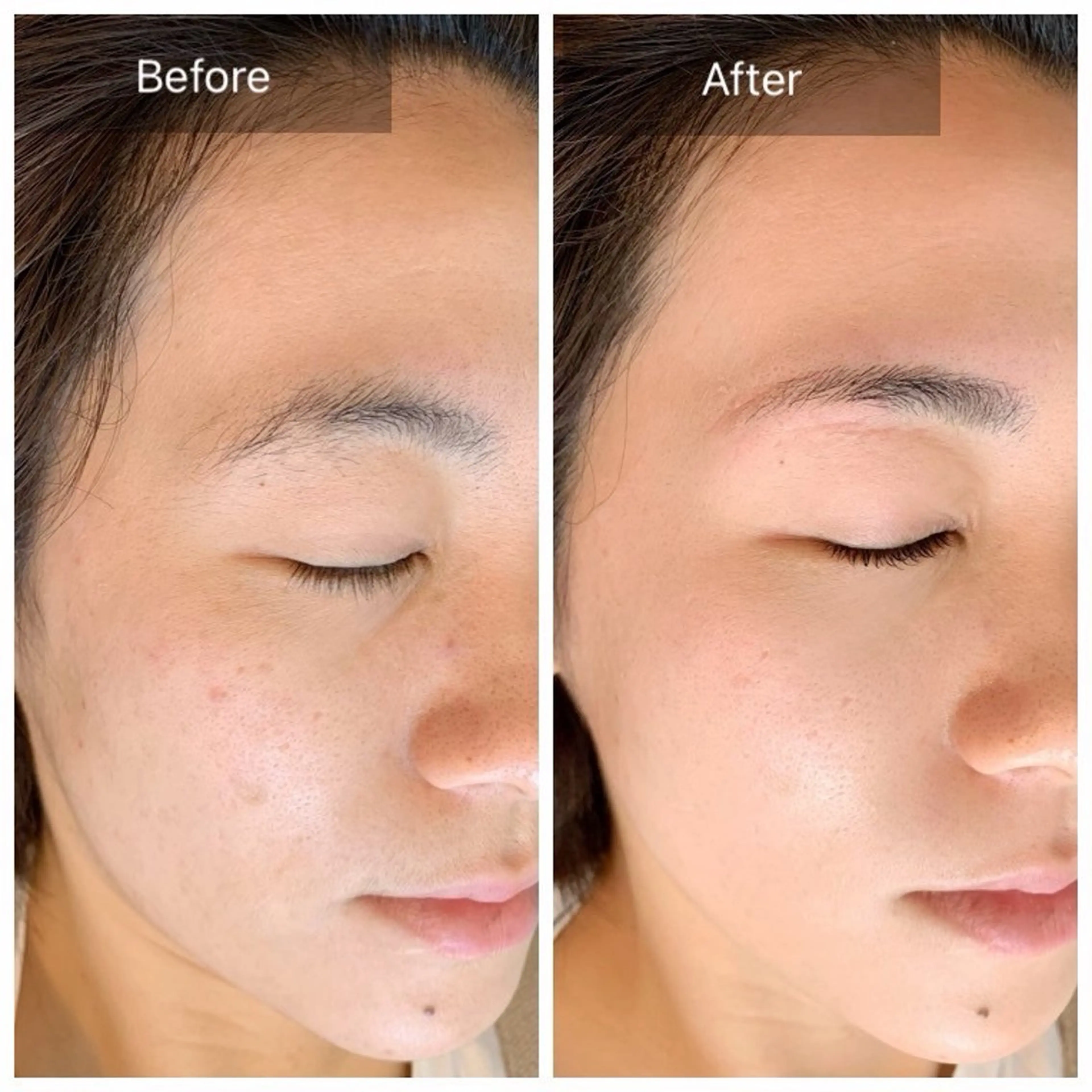 その他 EMINAL AOI✨のエステ・リラクイメージ