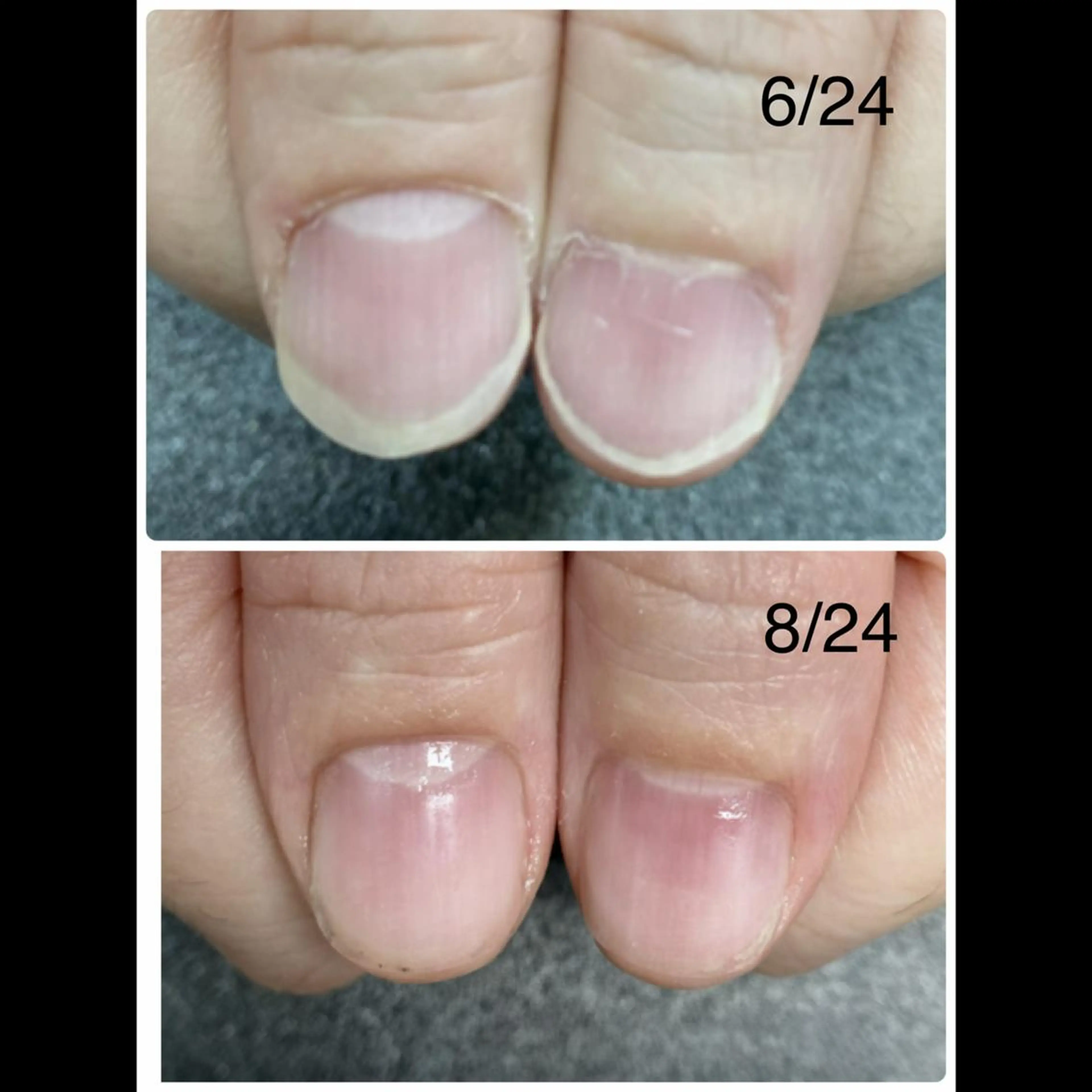 ネイル ハンドネイル ハンドケア 和田 悦子のネイルデザイン