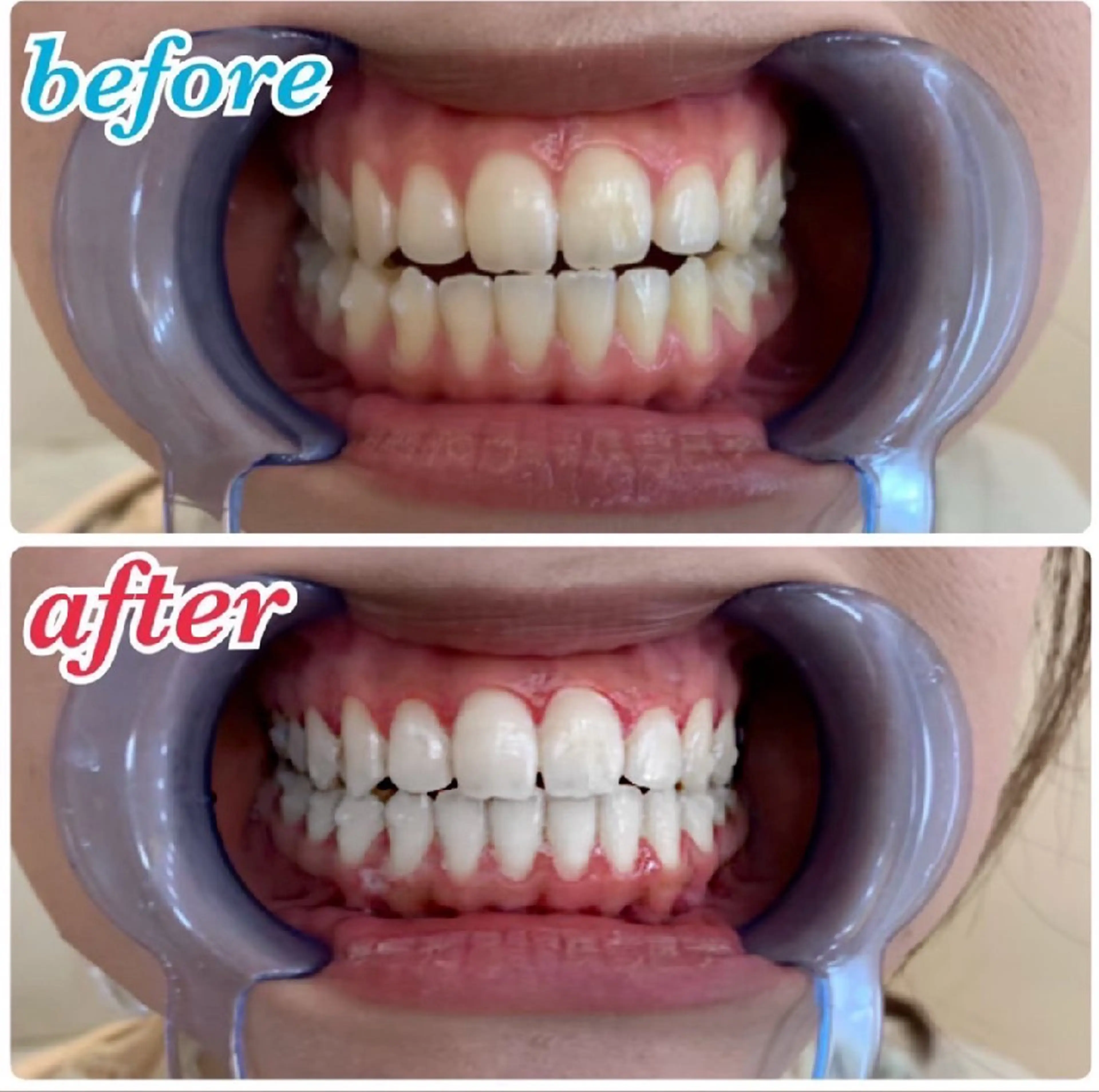 ecxia  white 　広島袋町店所属・セルフホワイトニング エクシア広島袋町店のその他イメージ