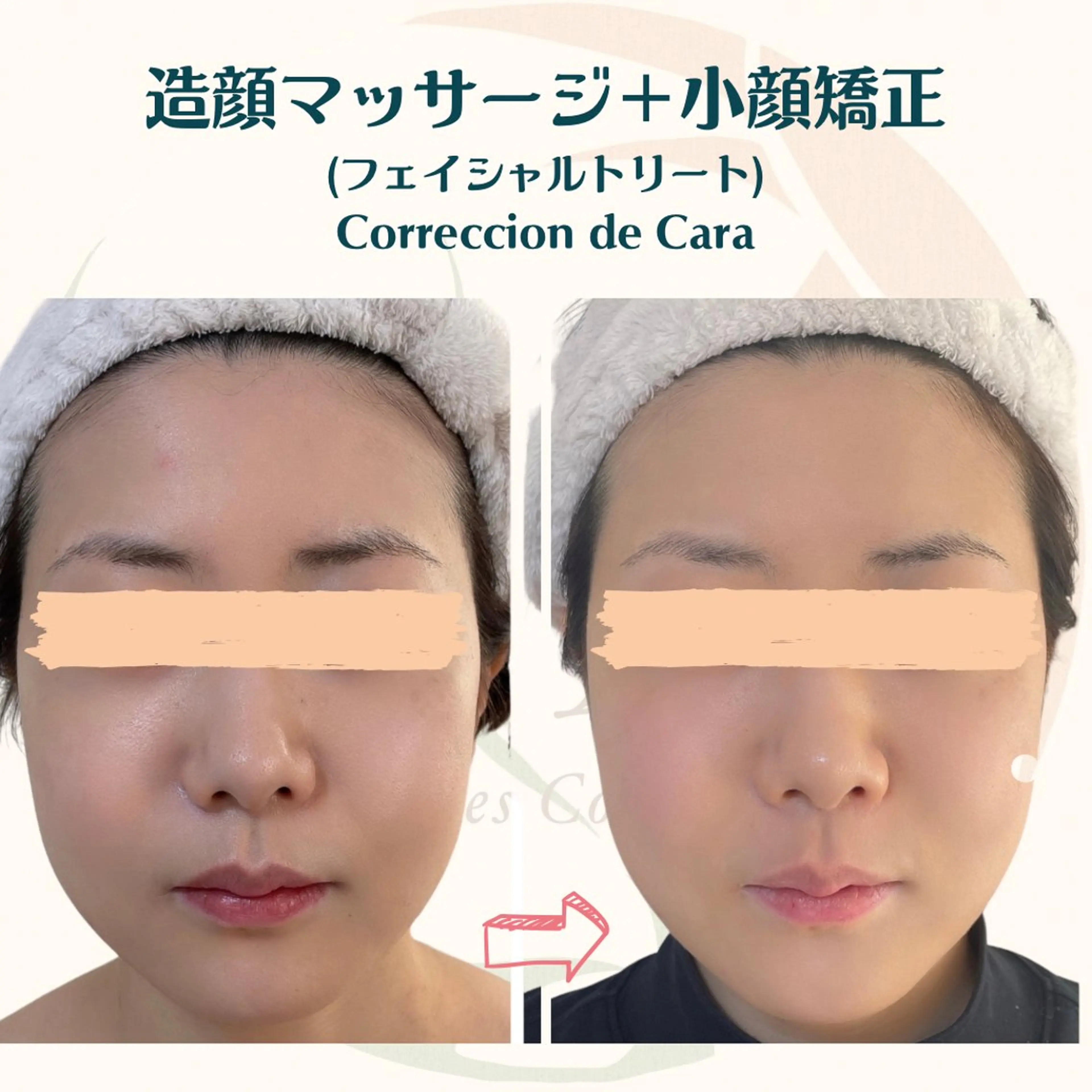 小顔矯正☀︎バスト ☀︎ハルのエステ・リラクイメージ