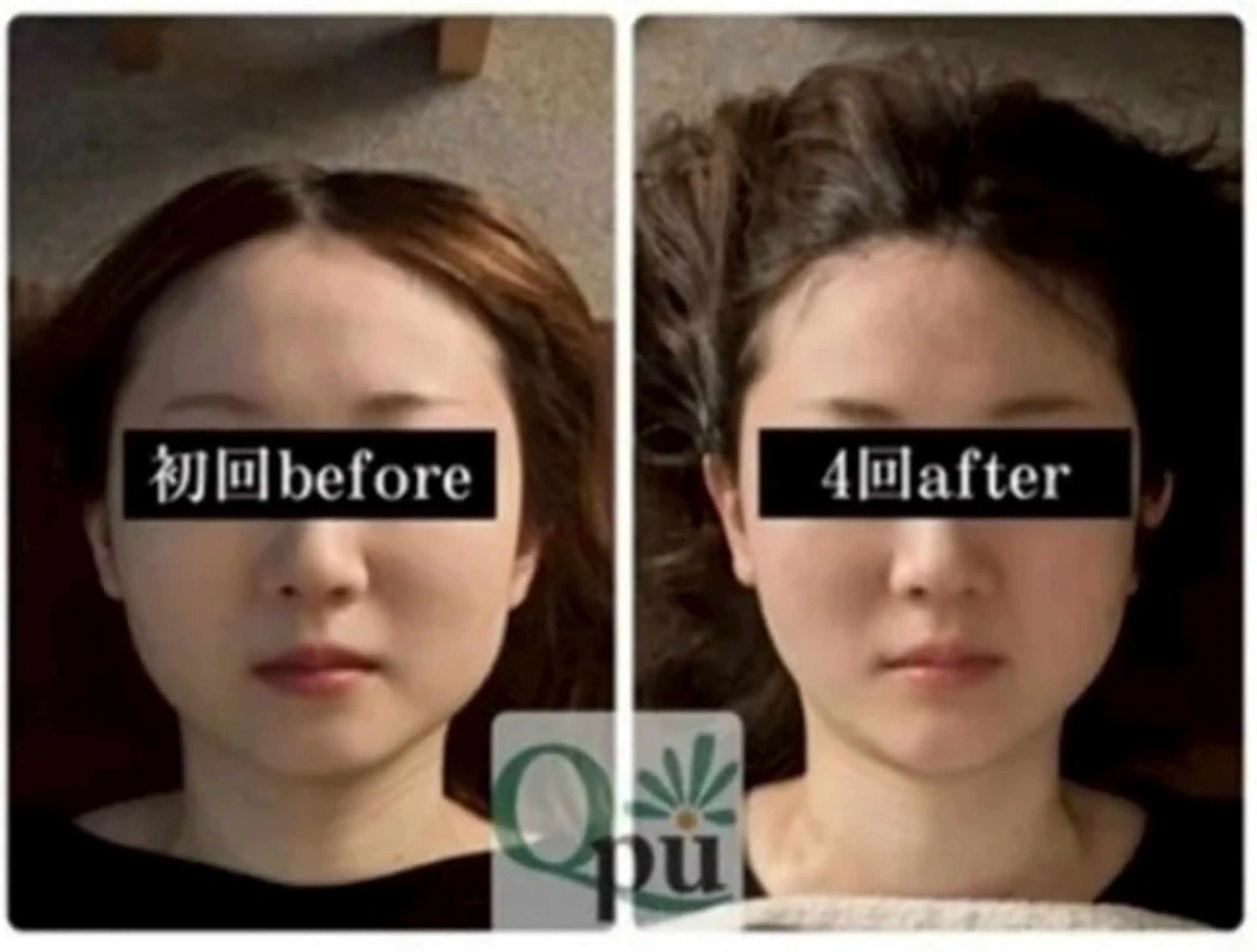 エステ リラク Qpu(キュープ)下北沢店所属・鮎川 さゆりのエステ・リラクイメージ