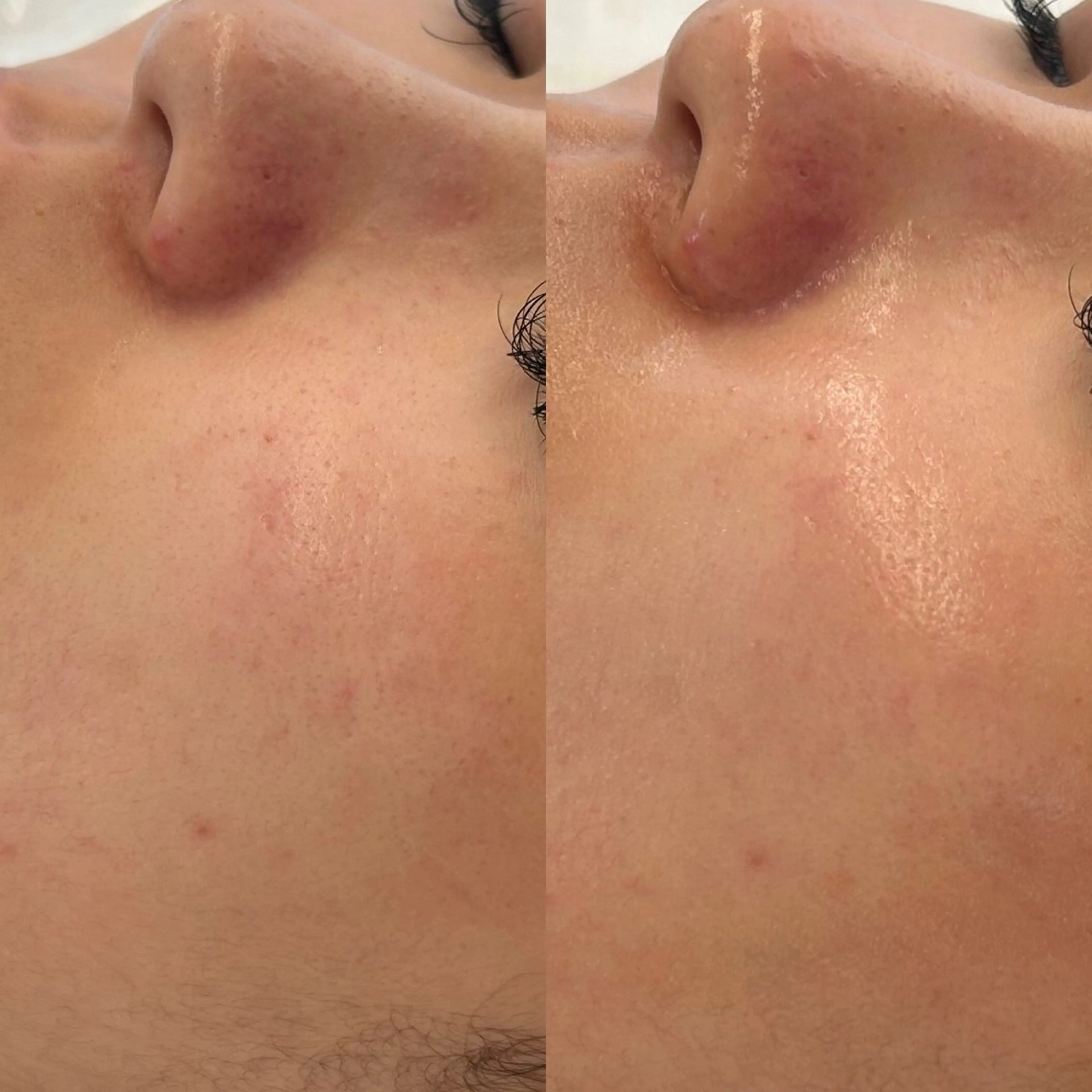 エステ 韓国🇰🇷価格 サロン_Nbibiのエステ・リラクイメージ