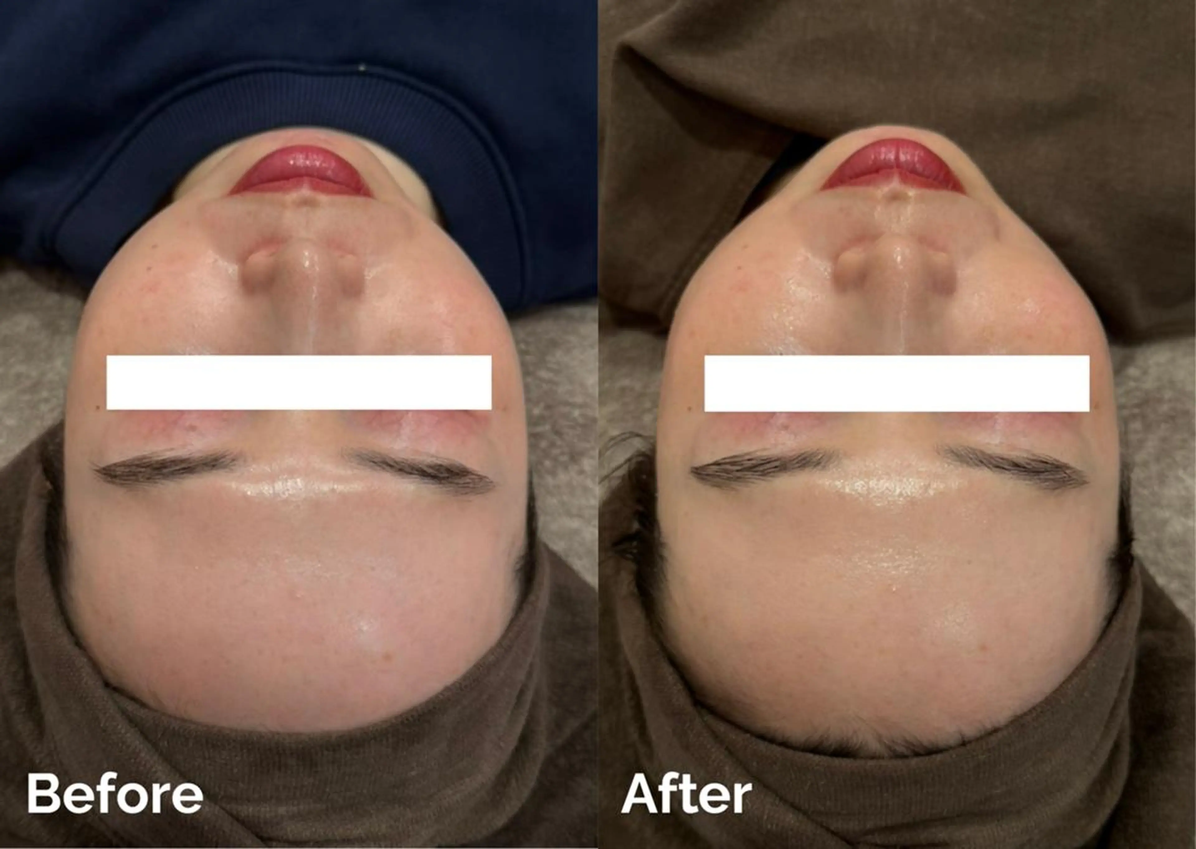 脱毛＆小顔；ミアンカ 京橋京阪モール店のエステ・リラクイメージ