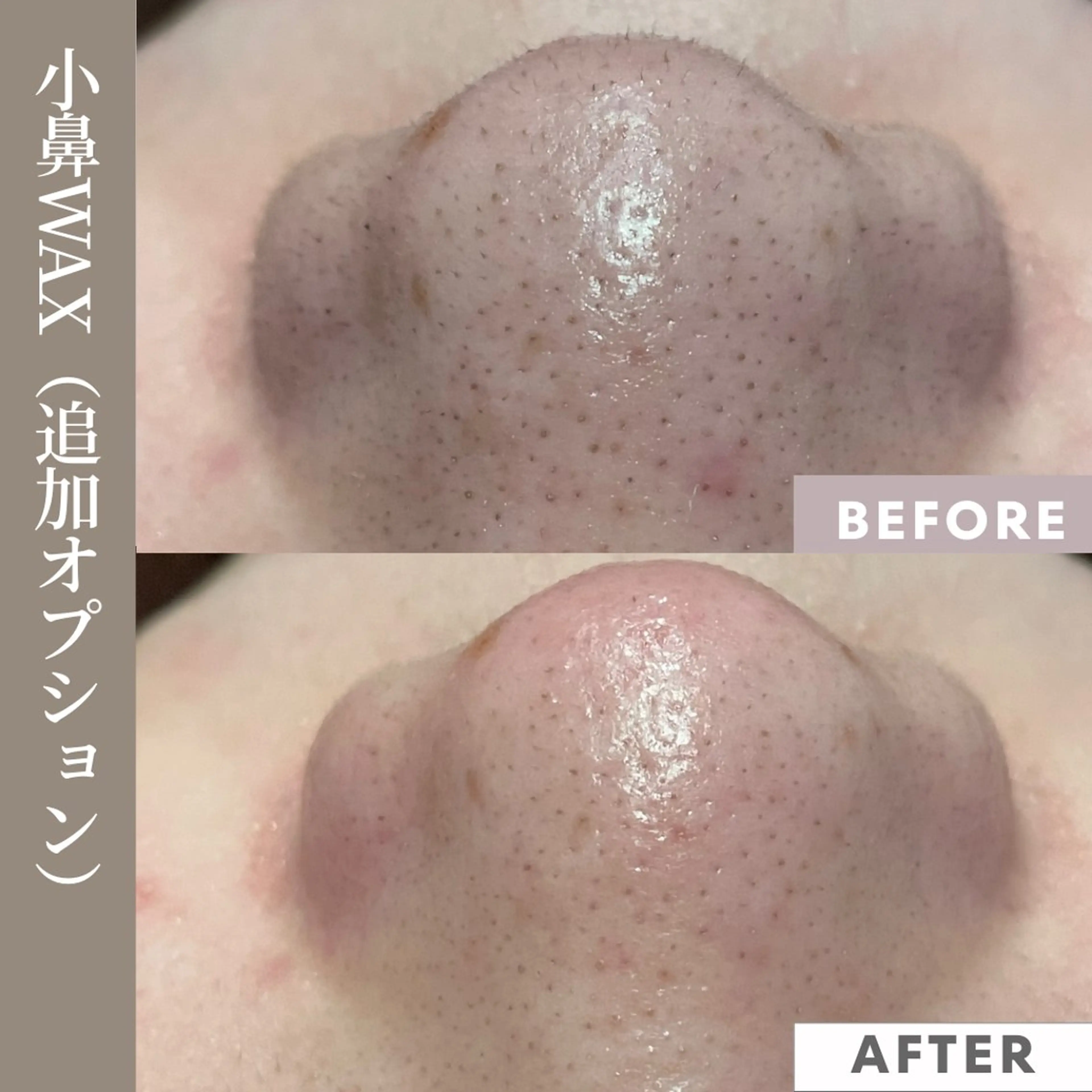 【フェムケア専門店】 PEQLIAヒロミのエステ・リラクイメージ