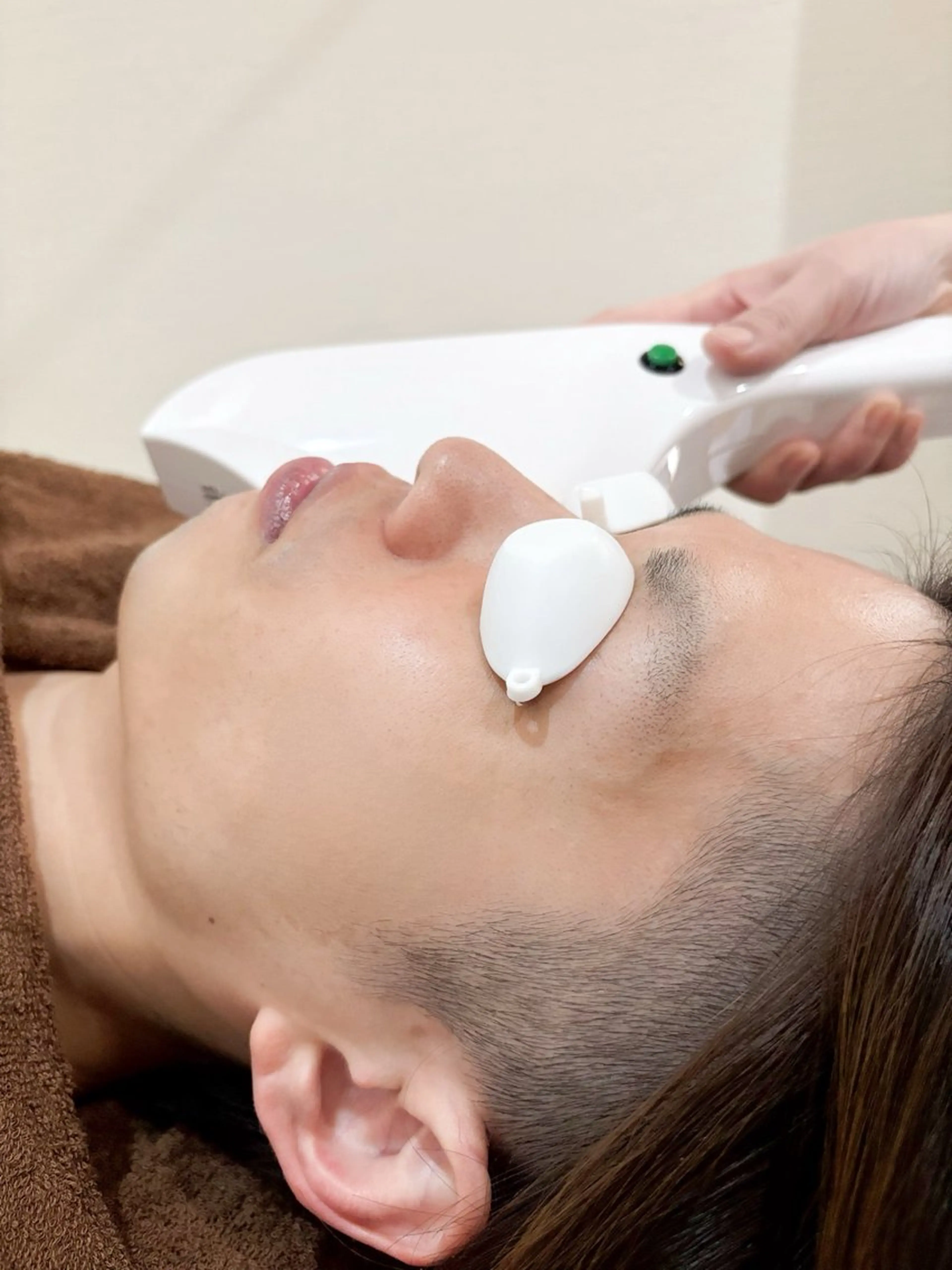 ⭐︎S Sパーツ脱毛⭐︎男性限定の写真