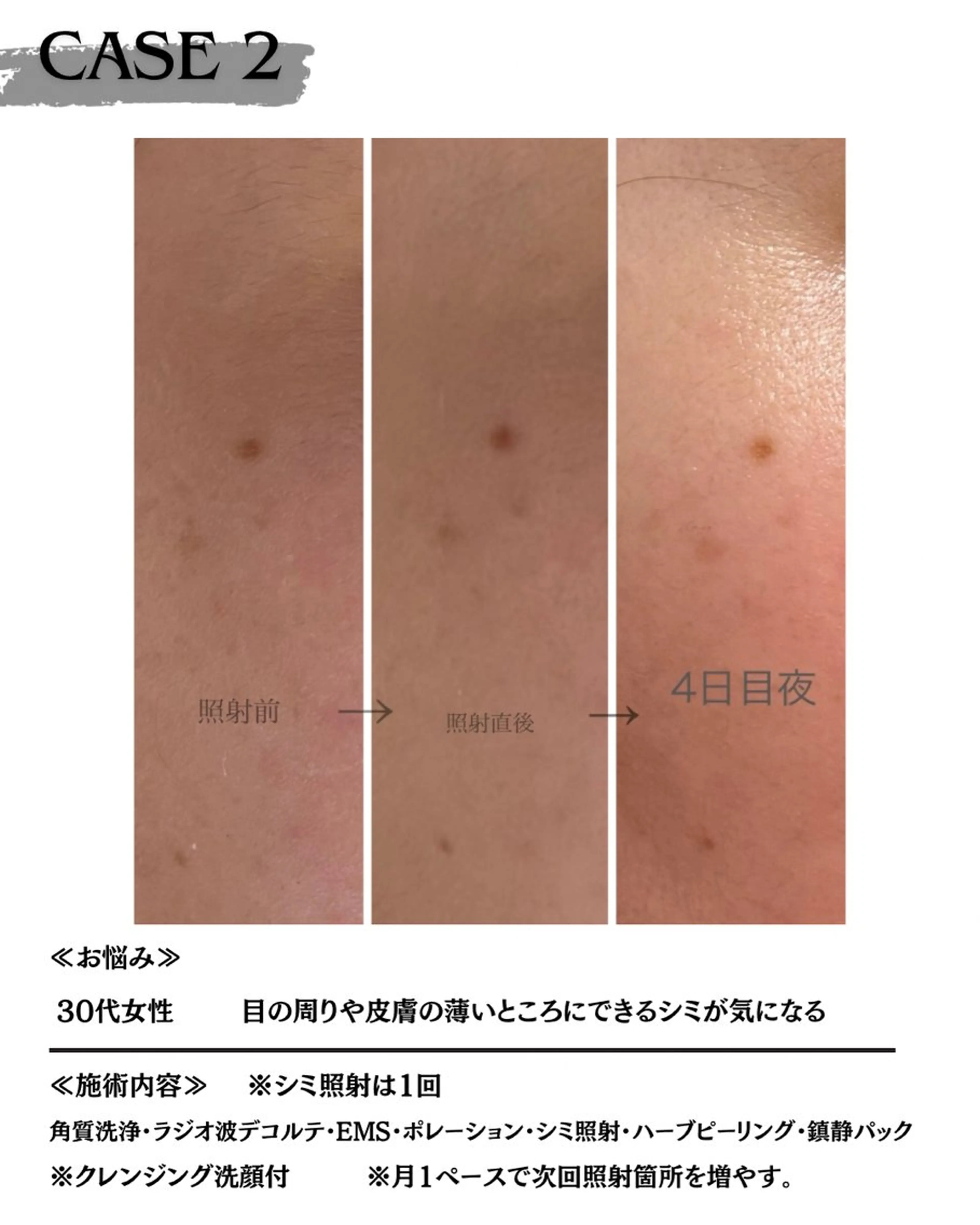 エステ 素肌育成・シミケア専門サロン美潤-miulu-所属・【医療提携サロン】 【シミケア専門】のエステ・リラクイメージ