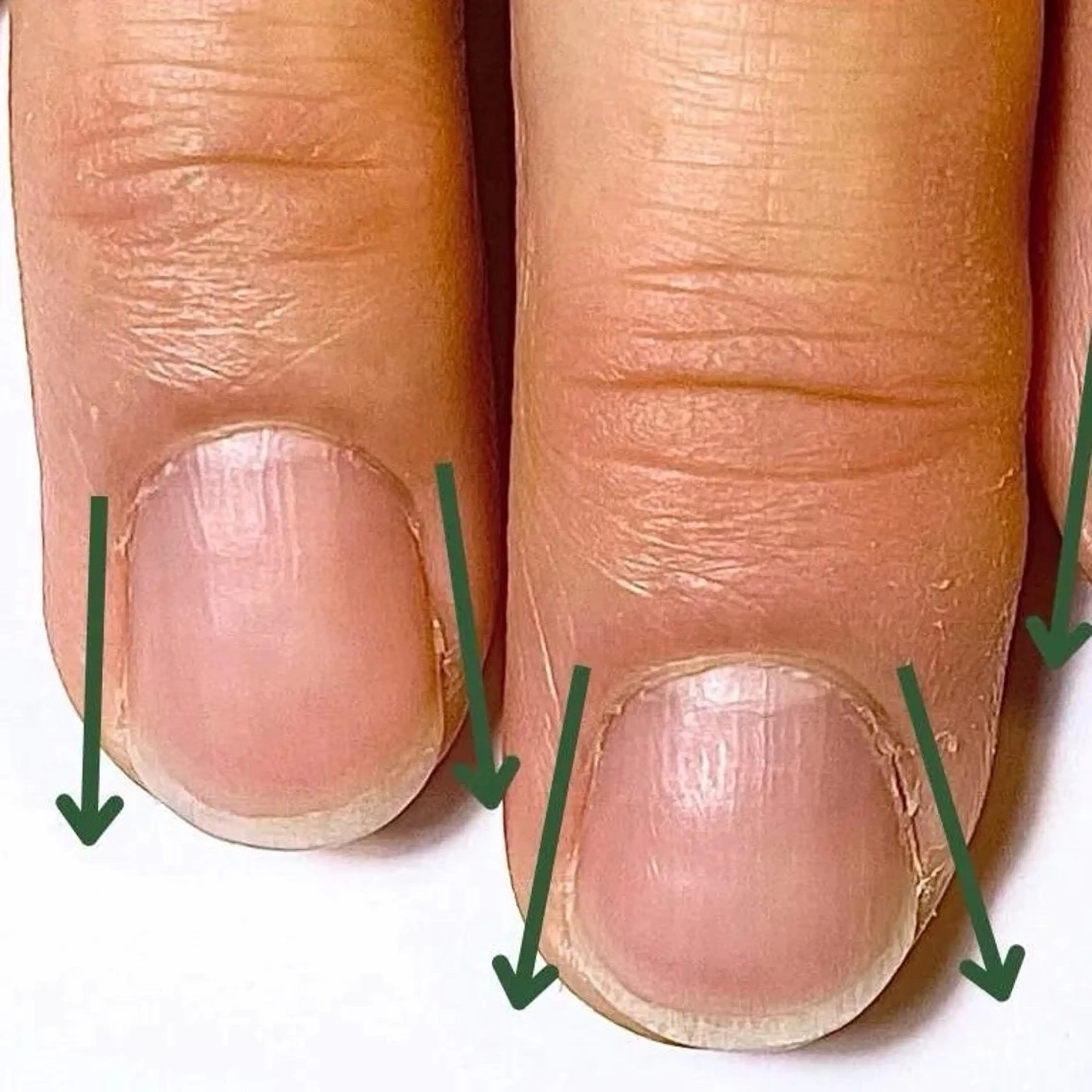 ネイル Y U K Iのネイルデザイン