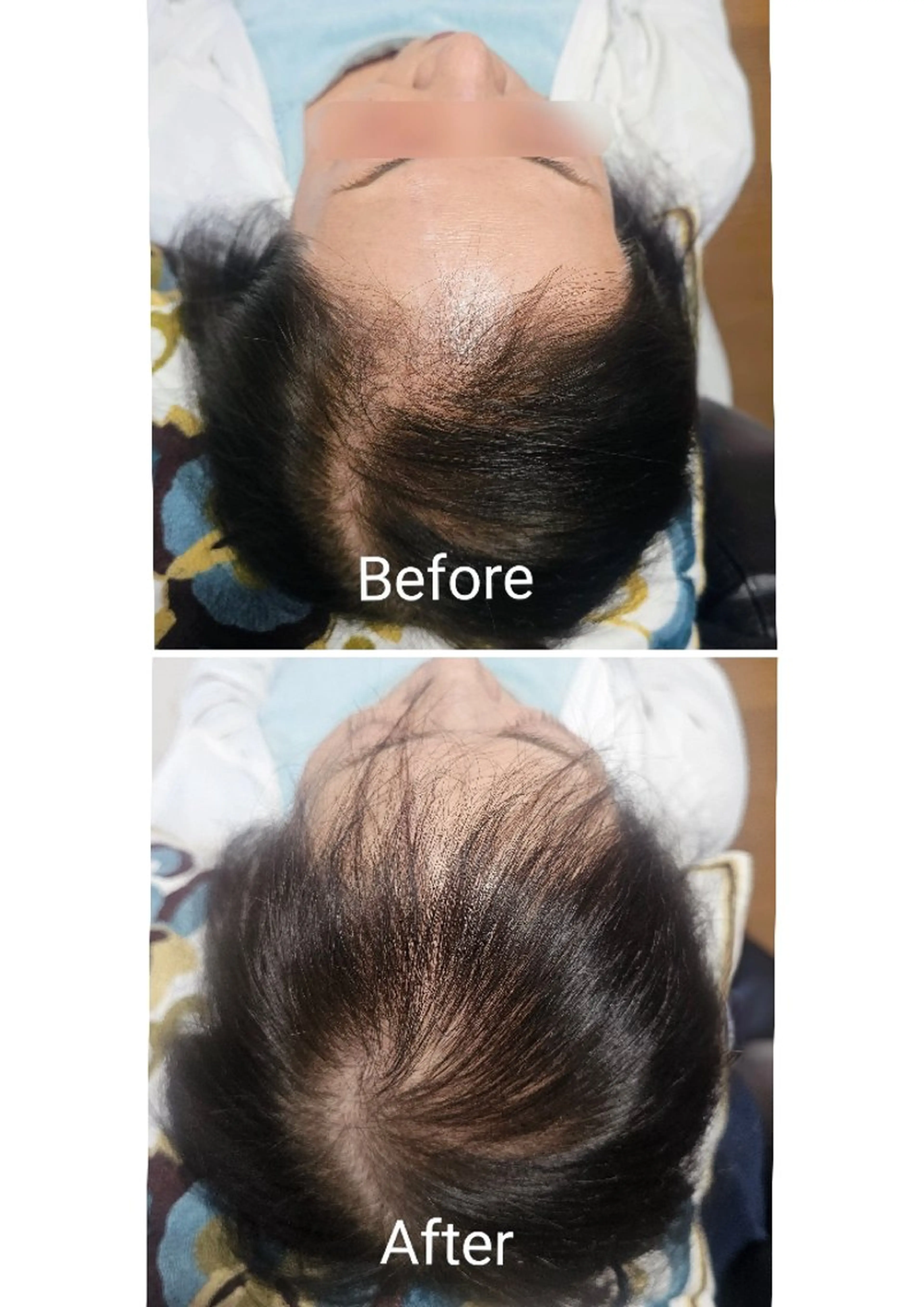 歯科提携セルフダック 宇都宮駒生店のエステ・リラクイメージ