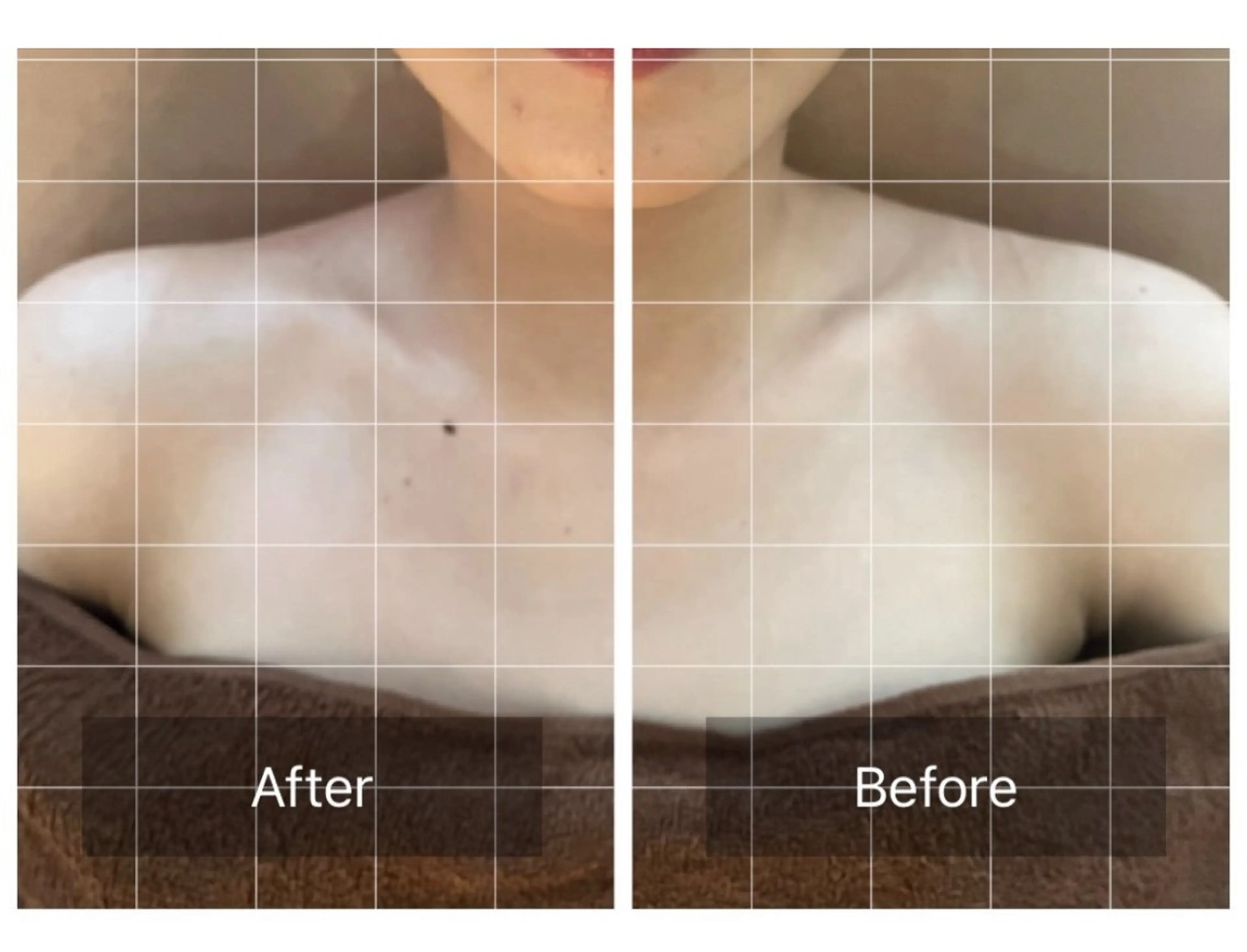 心斎橋痩身ダイエット 韓国.美容鍼.小顔のエステ・リラクイメージ