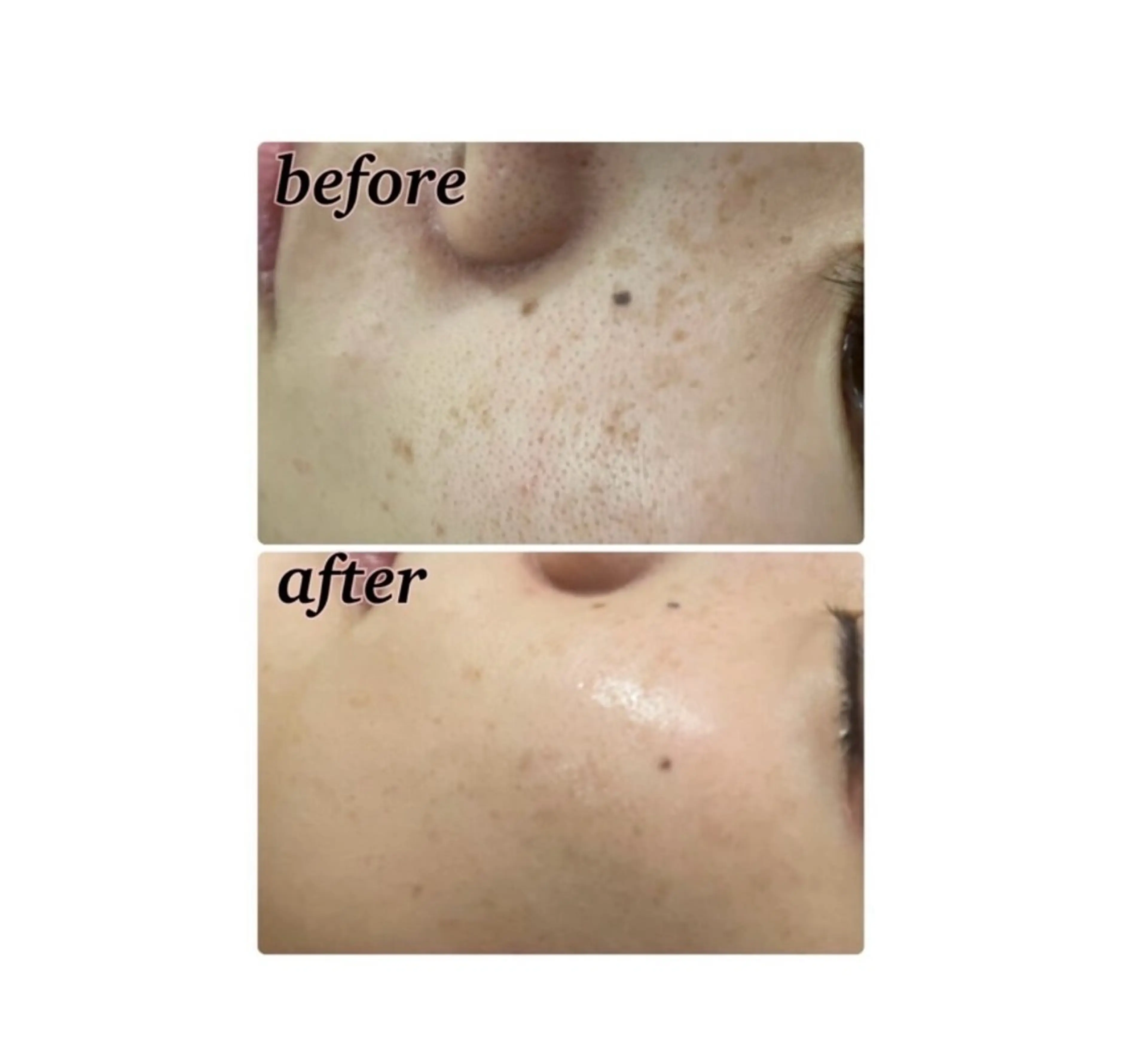 【folche】 フジイのエステ・リラクイメージ